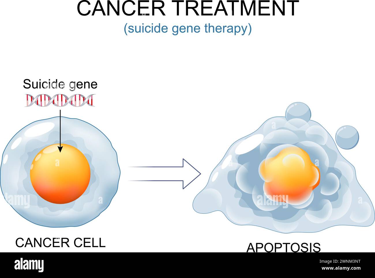 Cancer treatment. Cancer cell and DNA with Suicide gene. Cell before Suicide gene therapy and apoptosis. Antitumor immunity. Clinical trials. Programm Stock Vector