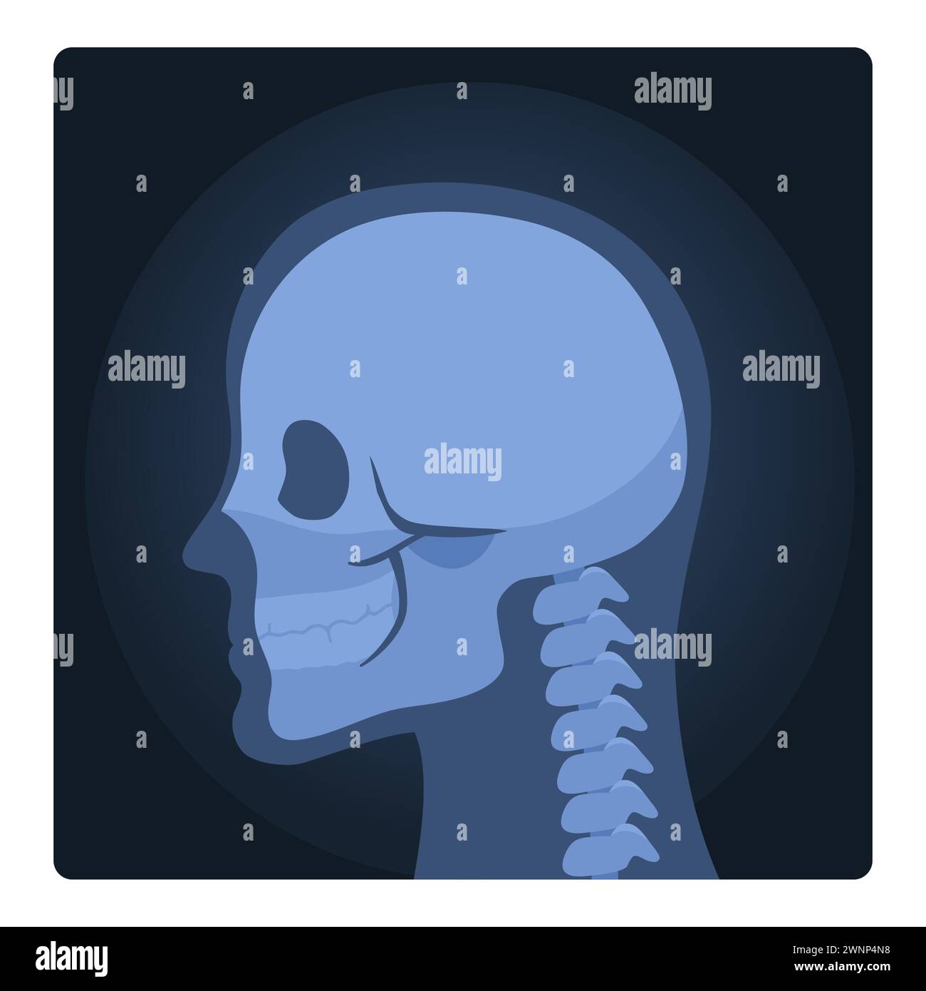 Medical xray scan of human head. Medical skeleton test, body ...