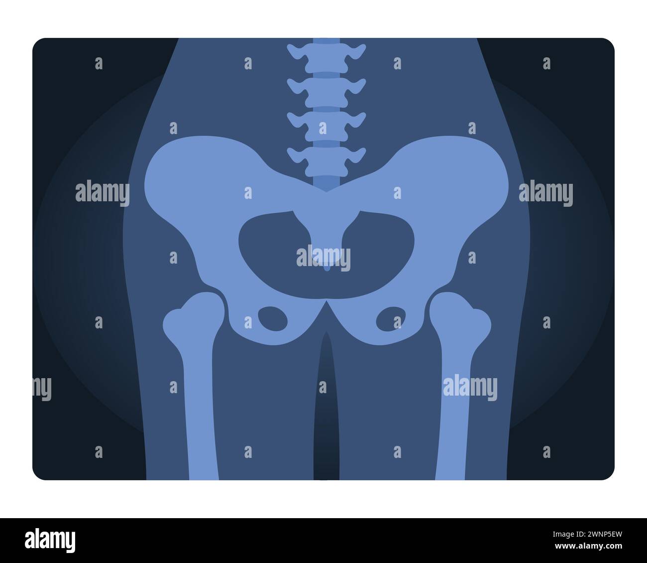 Xray shot of human pelvis. Medical skeleton test, body radiography cartoon vector illustration Stock Vector