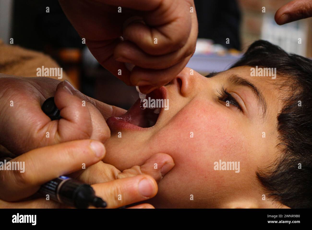 Non Exclusive: A health worker marks the finger of a child, after administers polio vaccine  child during a polio vaccination program for children 0-5 Stock Photo