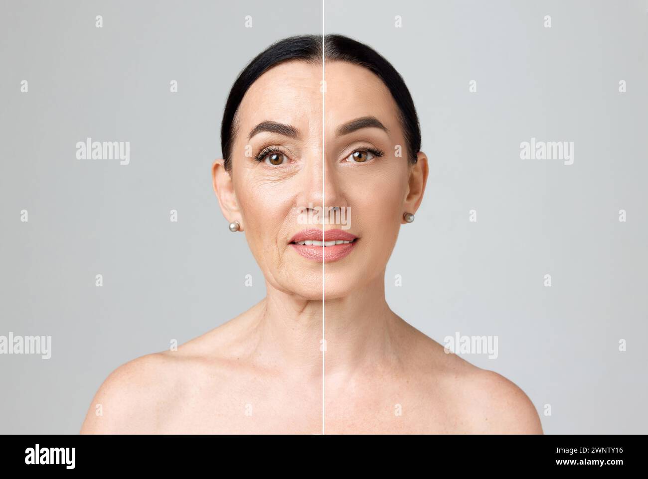 Before-after collage of mature woman showing aging signs and soft, smooth skin after facial care procedures against grey studio background. Stock Photo