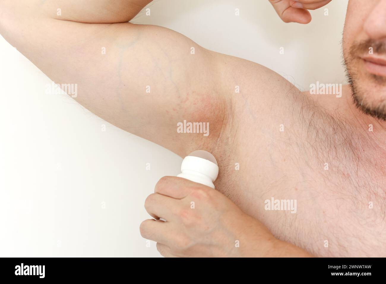 Deodorant rash hi-res stock photography and images - Alamy