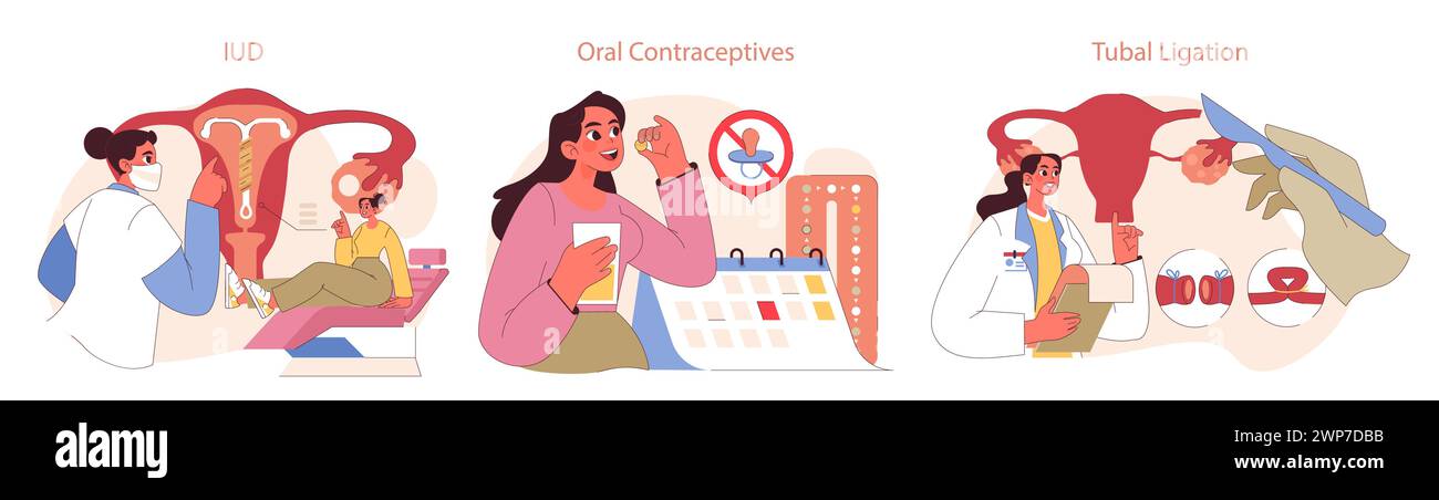 Types of Contraception set. Women consider IUD, oral contraceptives, and tubal ligation methods. Educational insight into reproductive choices. Flat vector illustration Stock Vector