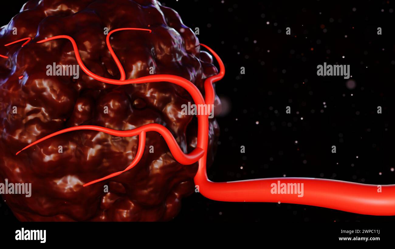3d rendering of cancer requires a blood supply to deliver the nutrients