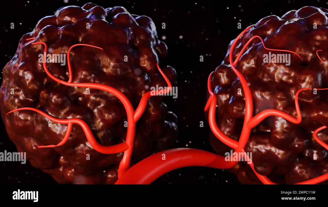 3d rendering of cancer requires a blood supply to deliver the nutrients ...