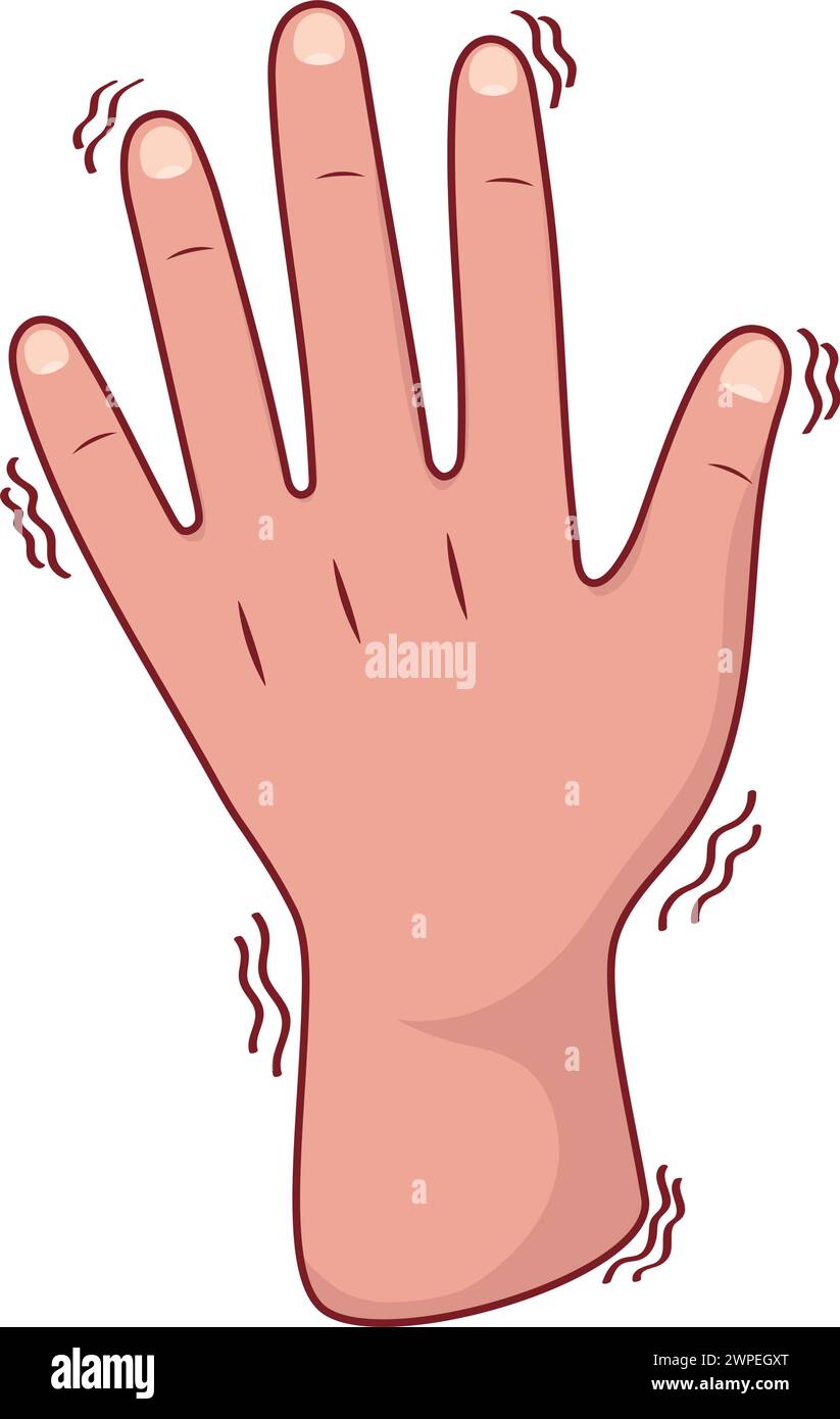 parkinson tremor on the hands Stock Vector