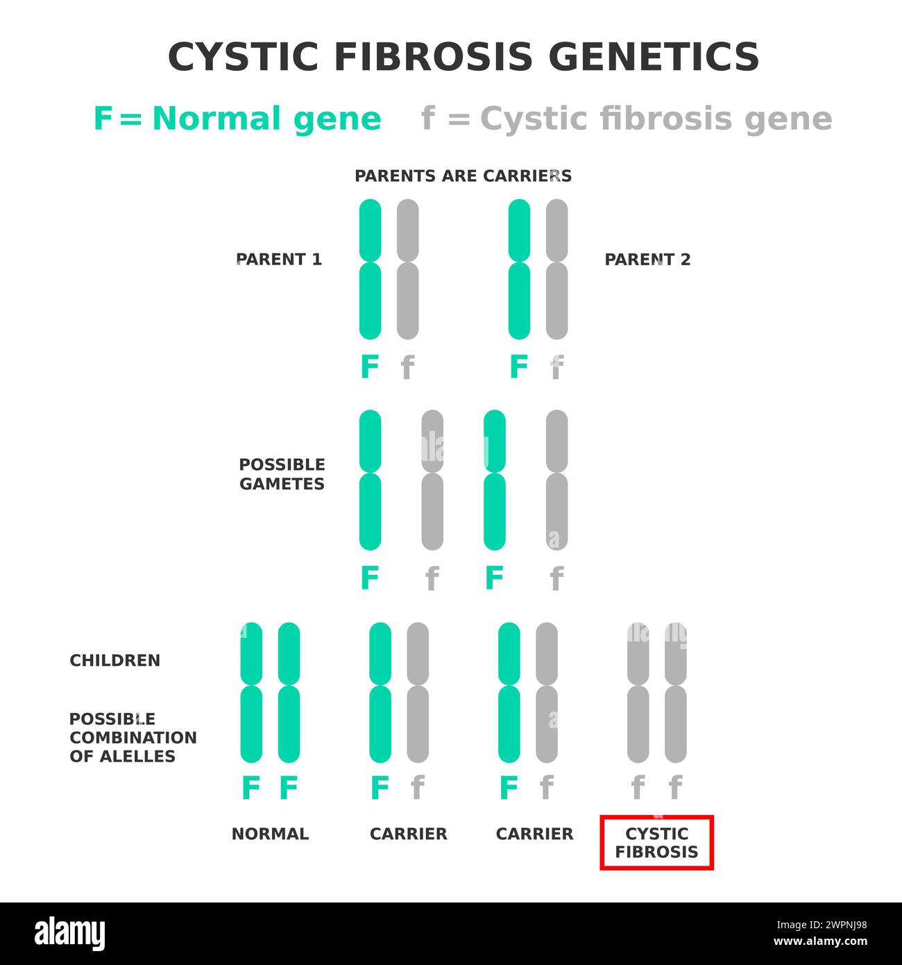 Cystic fibrosis genetics. Cystic fibrosis is an example of a recessive disease. Parents are carriers of affected allele. Vector illustration. Health. Stock Vector