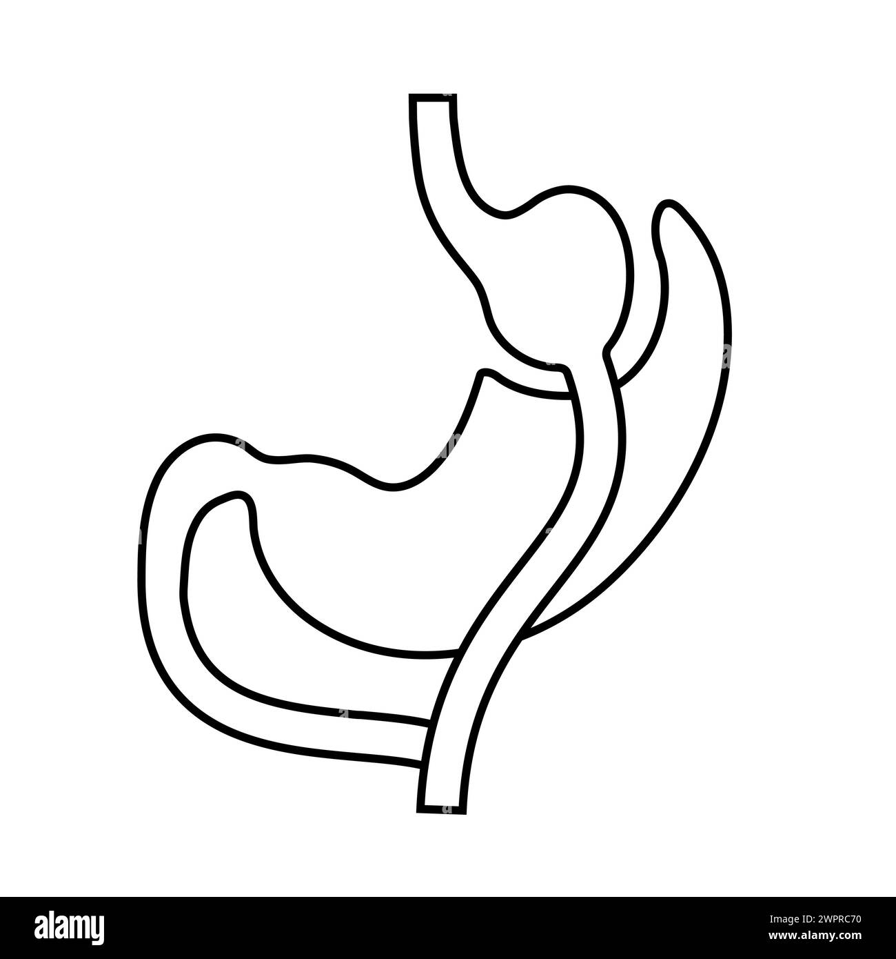 Gastric bypass surgery, illustration Stock Photo Alamy