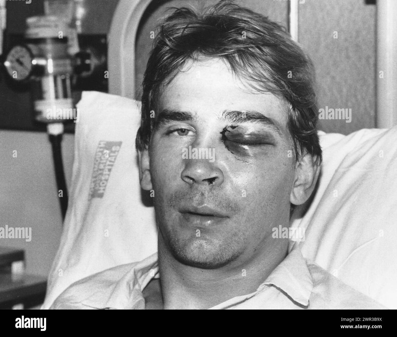 POMPEY GOALKEEPER ALAN KNIGHT IN HOSPITAL AFTER SUFFERING A FRACTURED CHEEK BONE AT WIMBLEDON, 1988 PIC MIKE WALKER 1988 Stock Photo