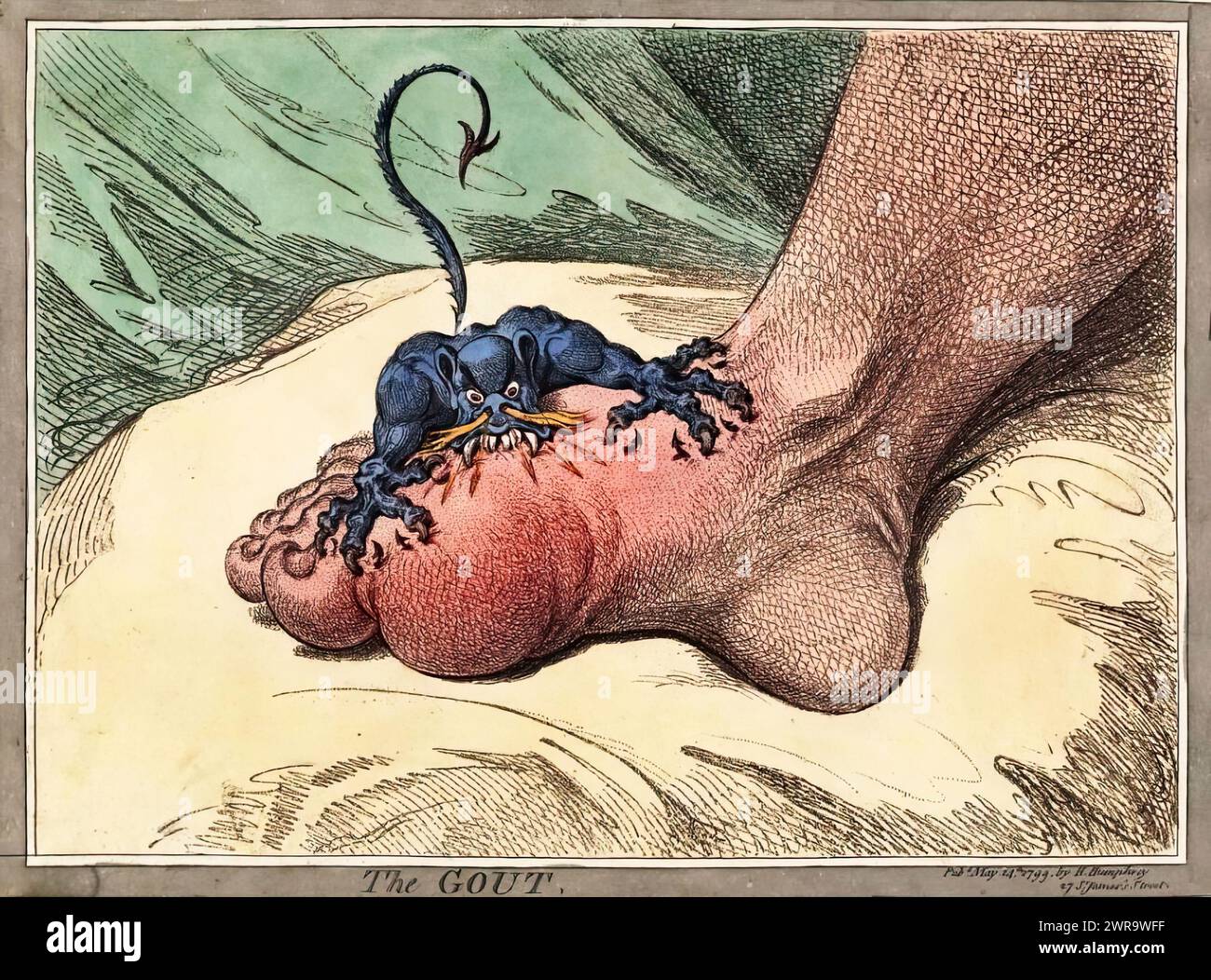 The Gout. James Gillray.   May 14th 1799. Stock Photo