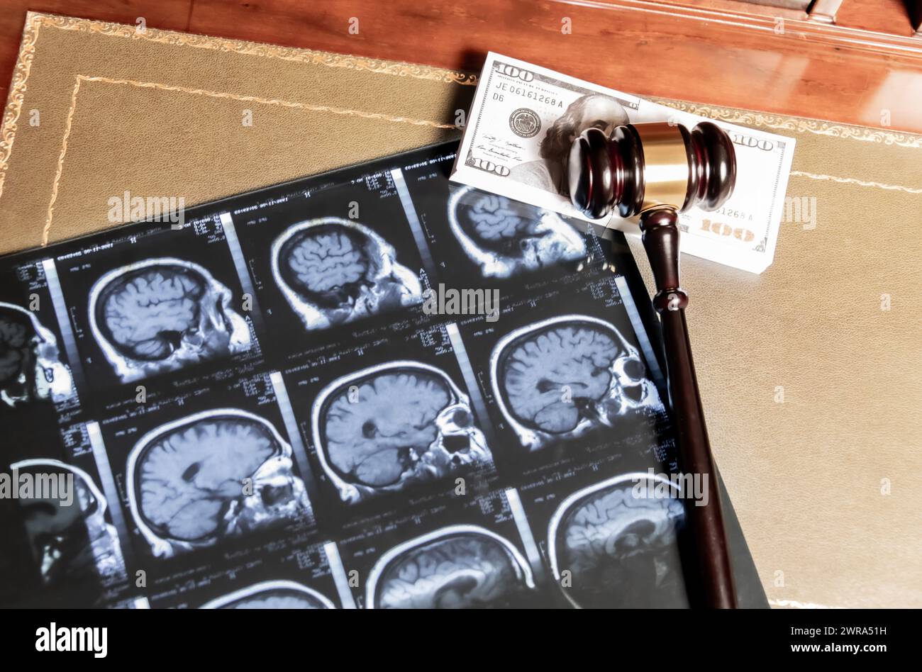 A composite of legal and medical concepts featuring brain MRI images, a gavel, and US currency. Stock Photo