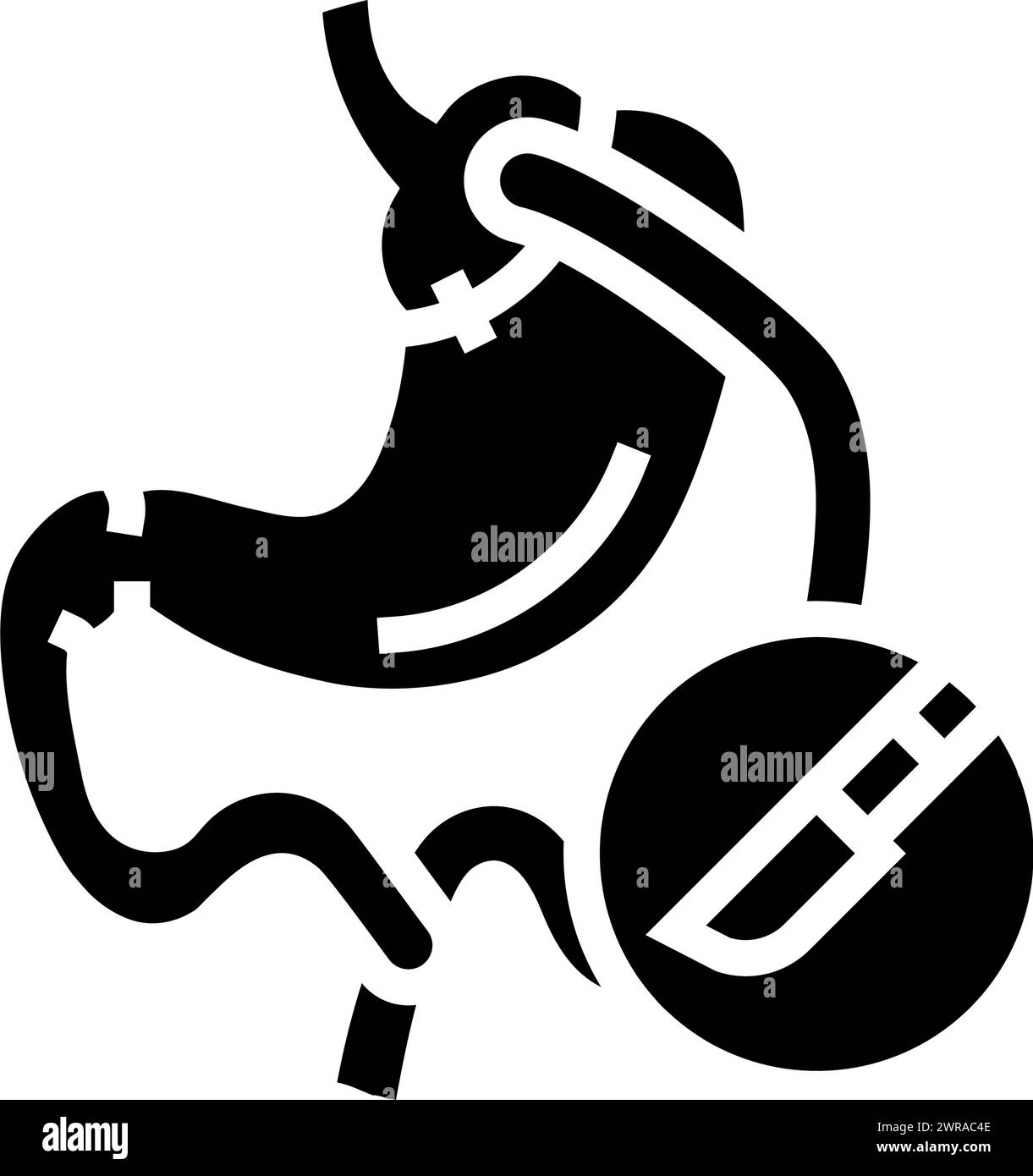 Gastric Bypass Surgery Glyph Icon Vector Illustration Stock Vector Image And Art Alamy