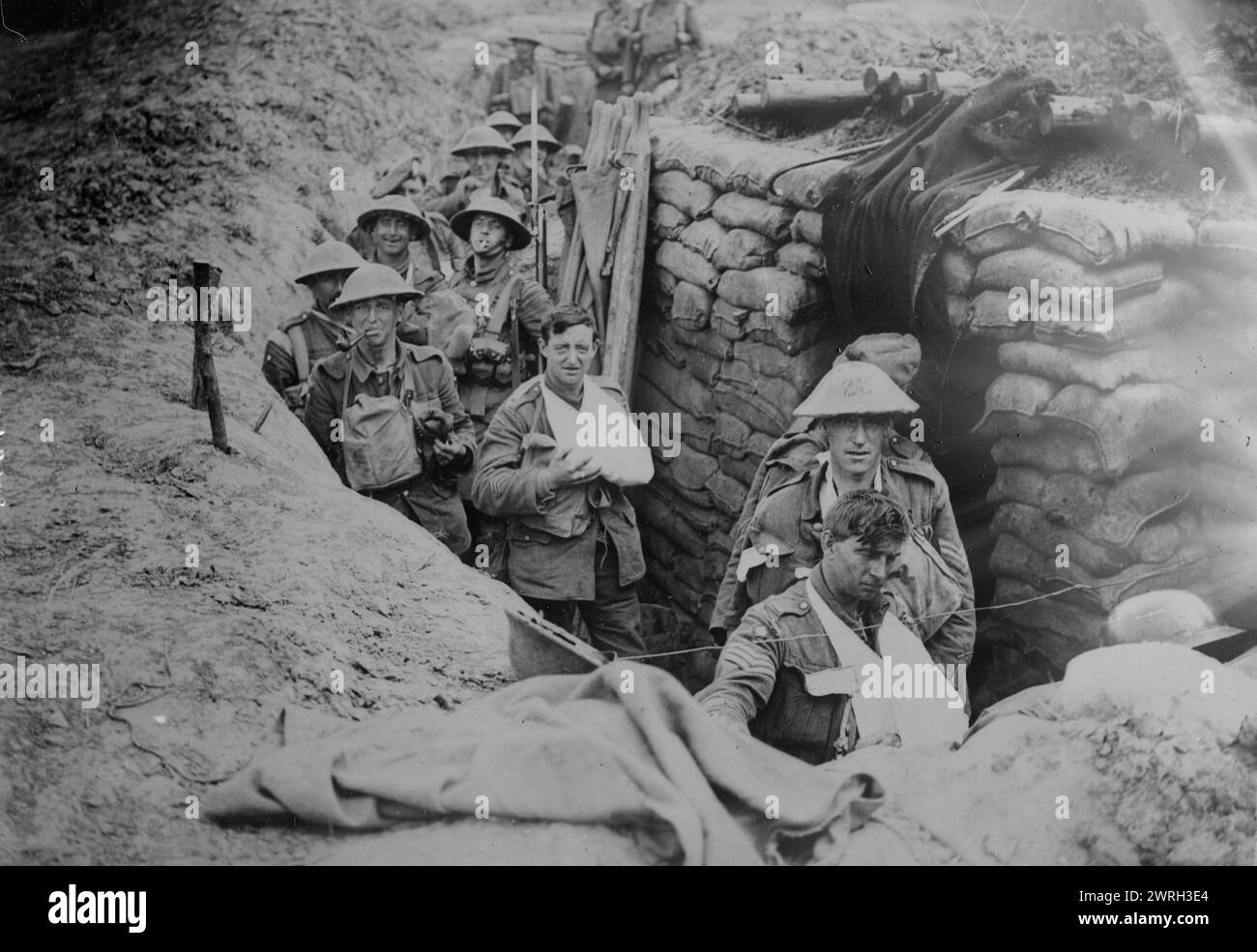Wounded British in trench, 18 Aug 1918. Wounded British soldiers of the 27th Brigade, 9th Division, in a trench at a regimental aid post near Outtersteene Ridge following the formation's successful attack on Outtersteene Ridge, Flanders, Belgium, August 18, 1918 during World War I. Stock Photo