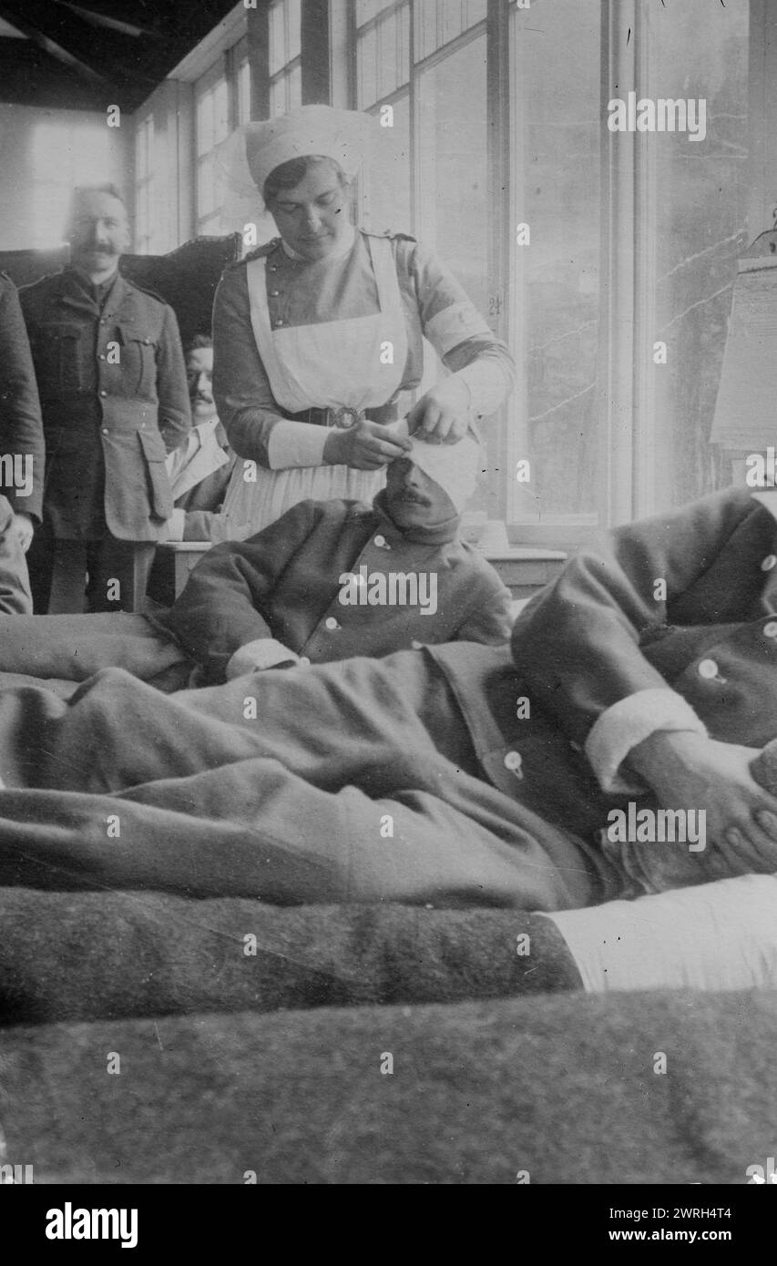 Corporal J. Mant in Canadian Hospital, Le Touquet, between c1910 and c1915. Nurse bandaging head of a soldier at the Canadian base hospital in the Hotel du Golf, Le Touquet, France during World War I. Stock Photo
