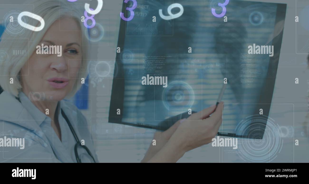 Image of numbers changing and scopes on screens over female doctor with x ray Stock Photo