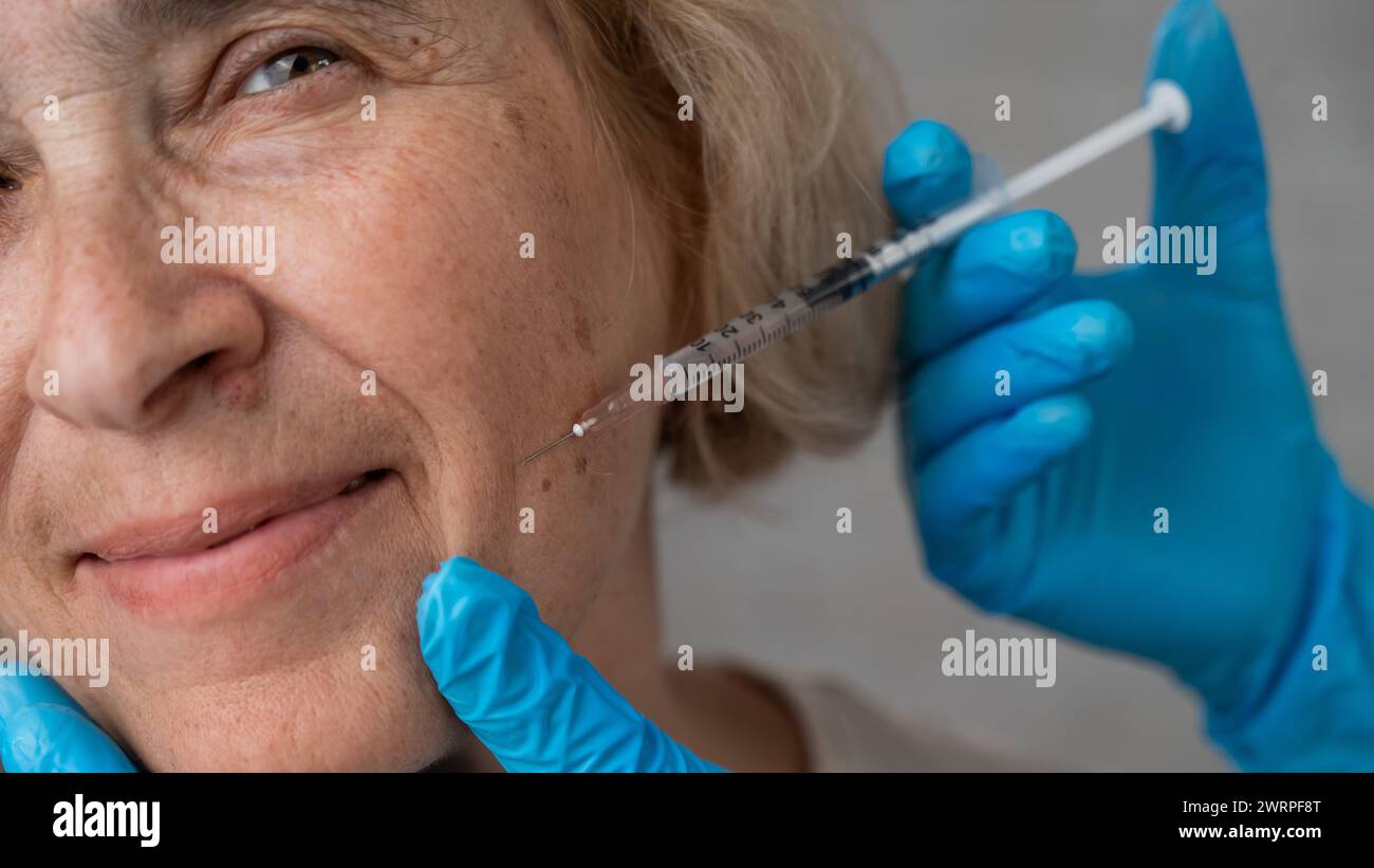 Doctor makes beauty injections in the face of an old caucasian woman.  Stock Photo