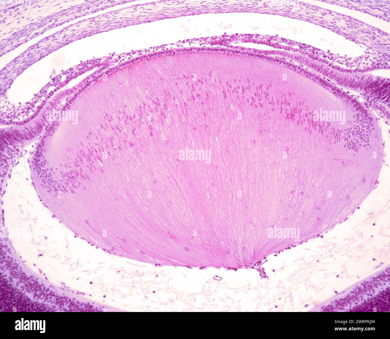 Lens fibres, light micrograph Stock Photo - Alamy