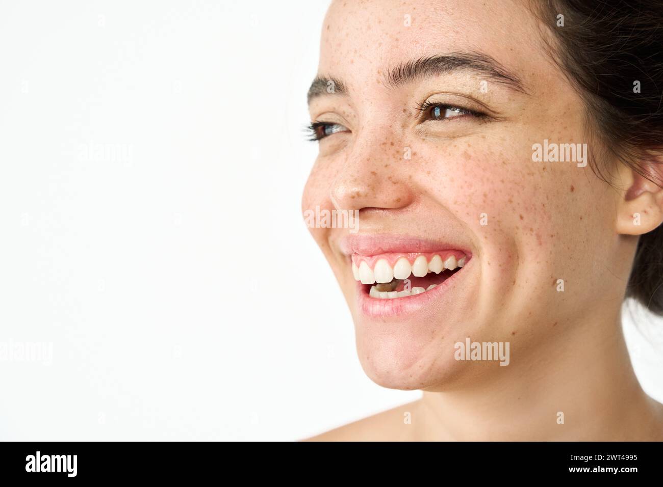 Happy young woman freckled face dental smile isolated on white. Skin care. Stock Photo