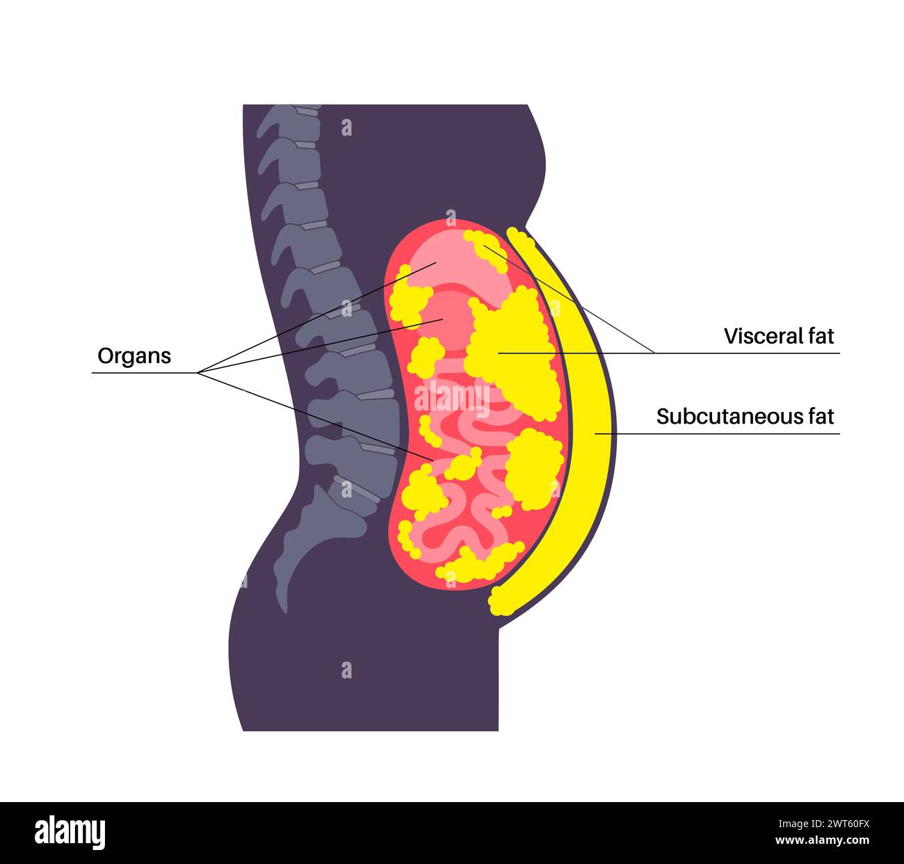 Visceral fat diagram, illustration. Belly fat surrounds internal organs ...