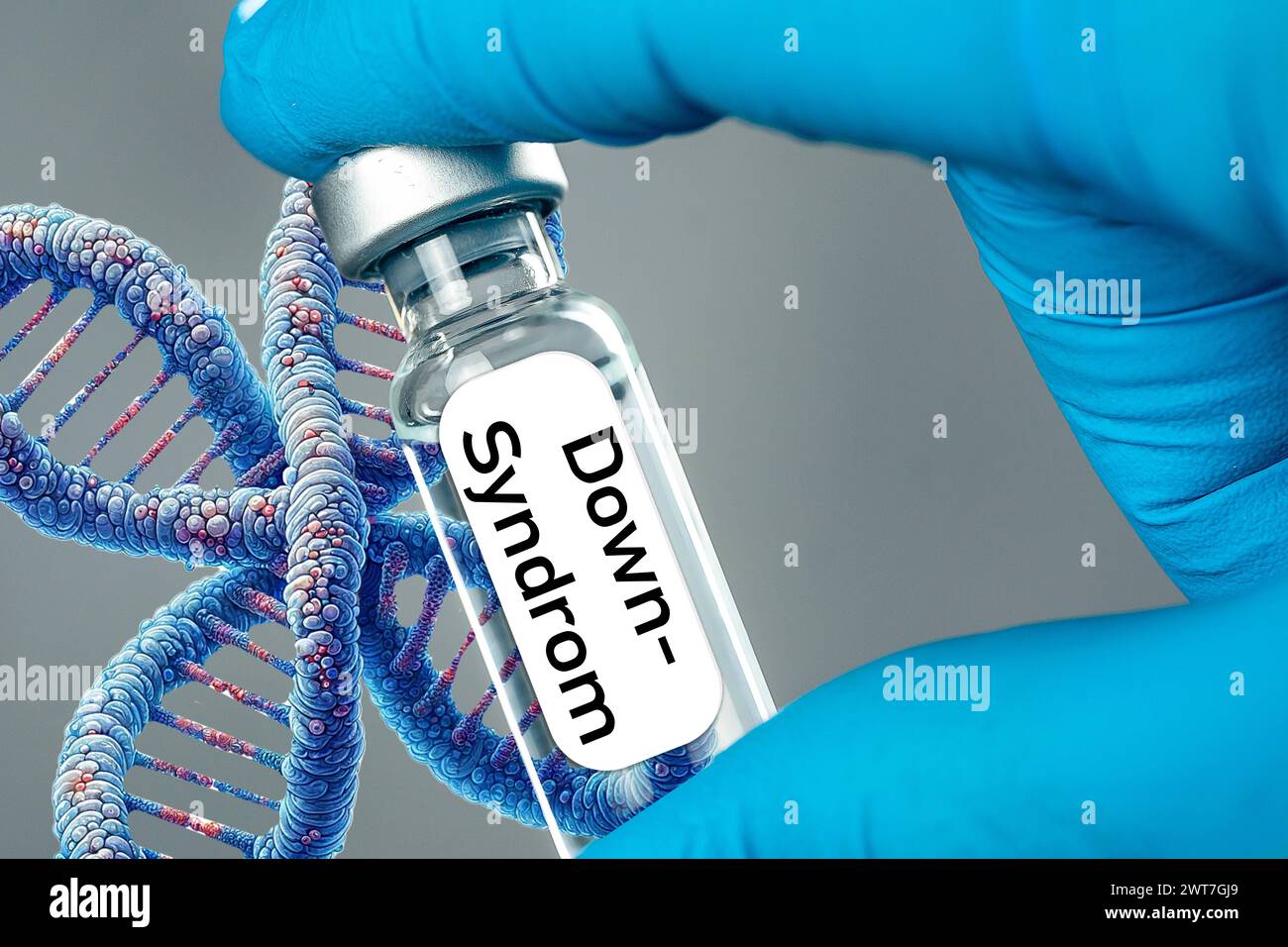 16 March 2024: Medical gloves with a chromosome and a vial for laboratory testing labeled: Down syndrome. PHOTOMONTAGE *** Medizinische Handschuhe mit einem Chromosom und einem Fläschchen zur Labor Untersuchung mit Aufschrift: Down-Syndrom. FOTOMONTAGE Stock Photo