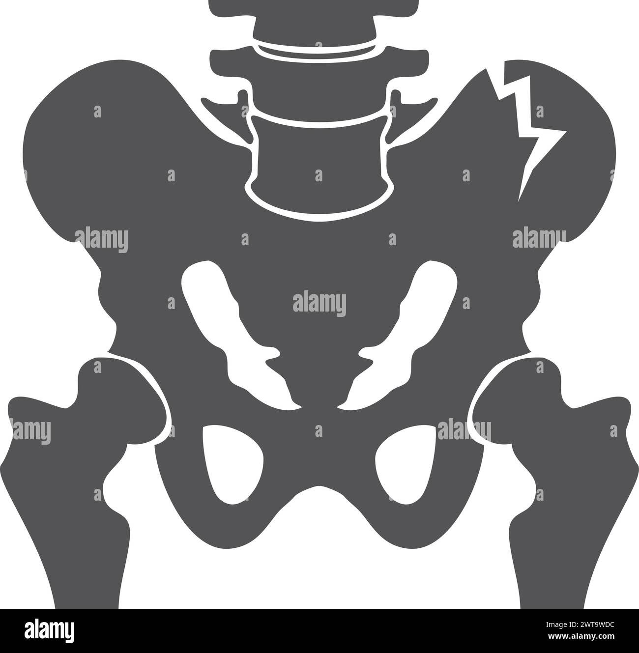 Human pelvis crack black icon. Injury illustration Stock Vector
