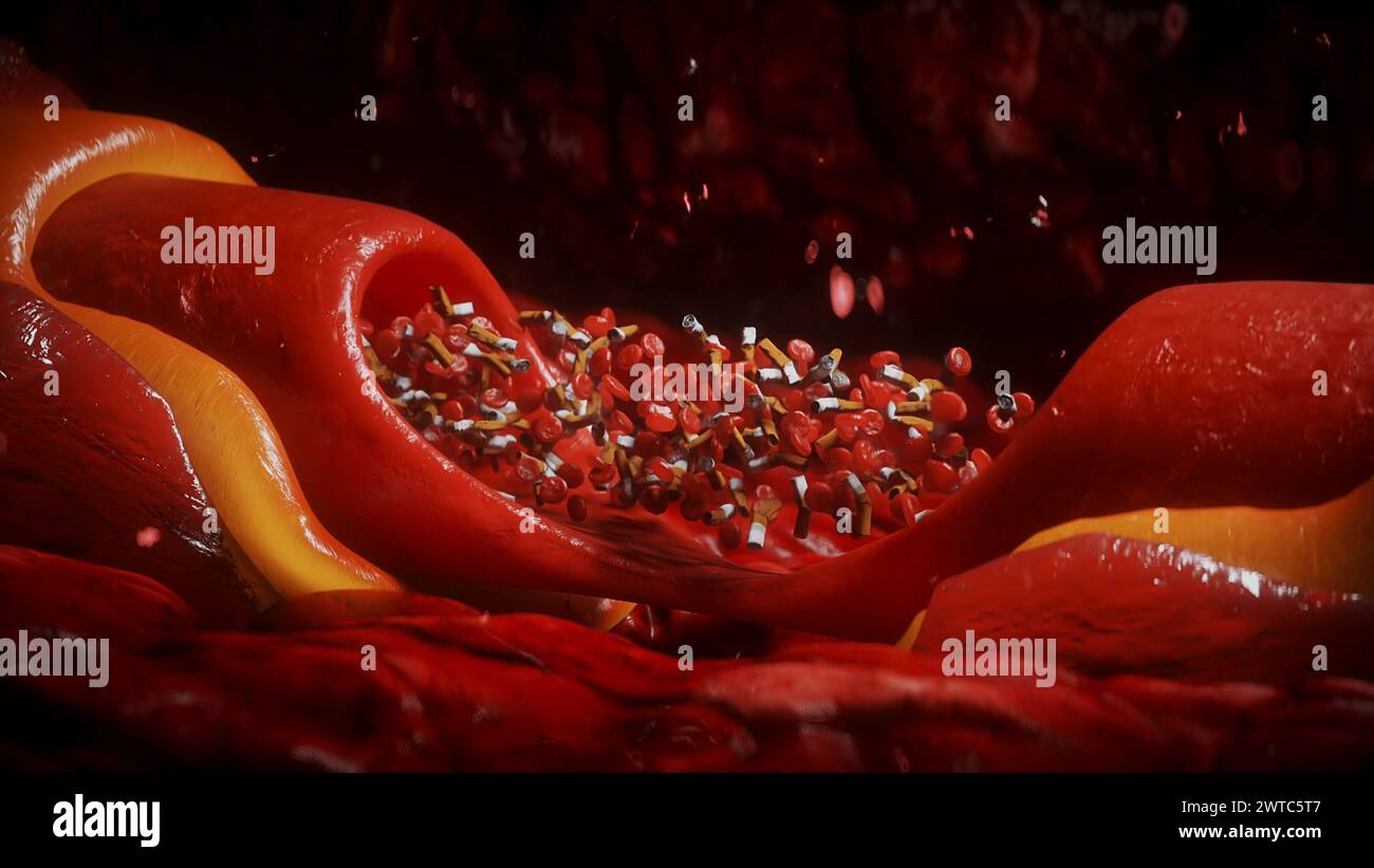 Blood Stream blood stream and cigarette butts. smoking health harm concept. Inside ...