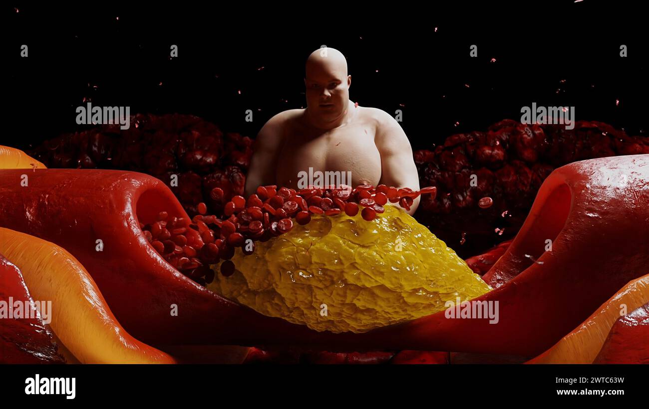 3d human body fat heart hi-res stock photography and images - Alamy
