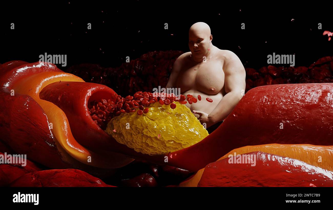 3d human body fat heart hi-res stock photography and images - Alamy