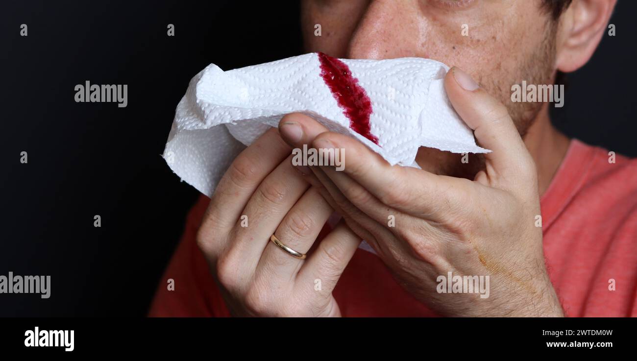 Man holding a bloody handkerchief in his hand, closeup Stock Photo