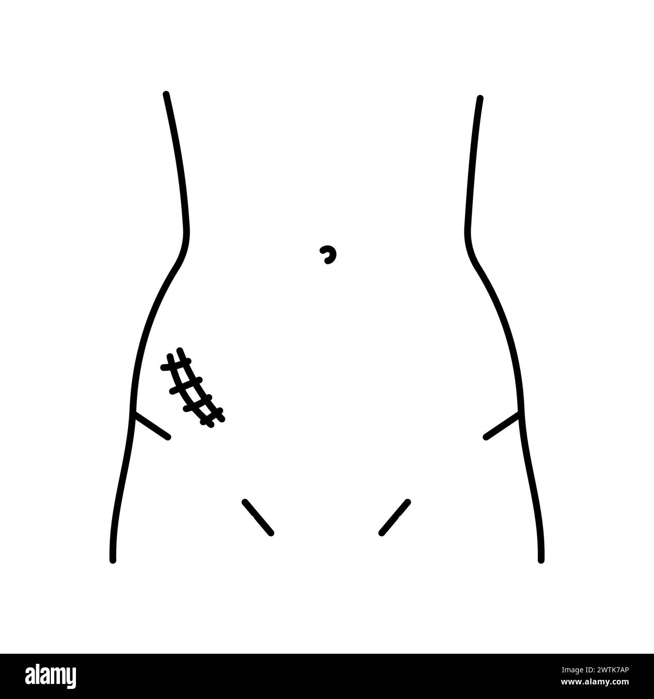 Mcburney incision line icon. Abdominal incisions. Vector isolated ...