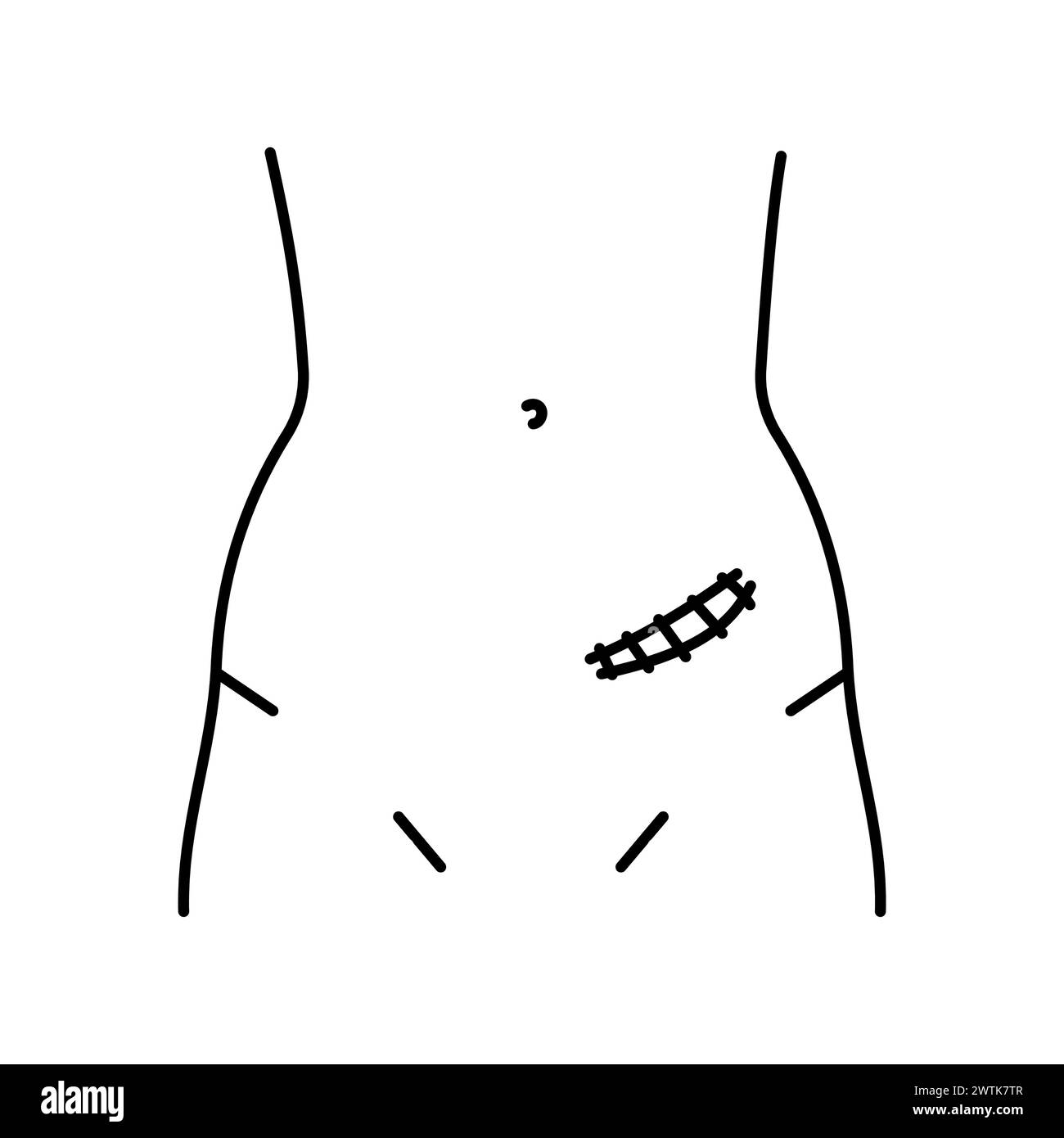 Rutherford morrison incision line icon. Abdominal incisions. Vector ...