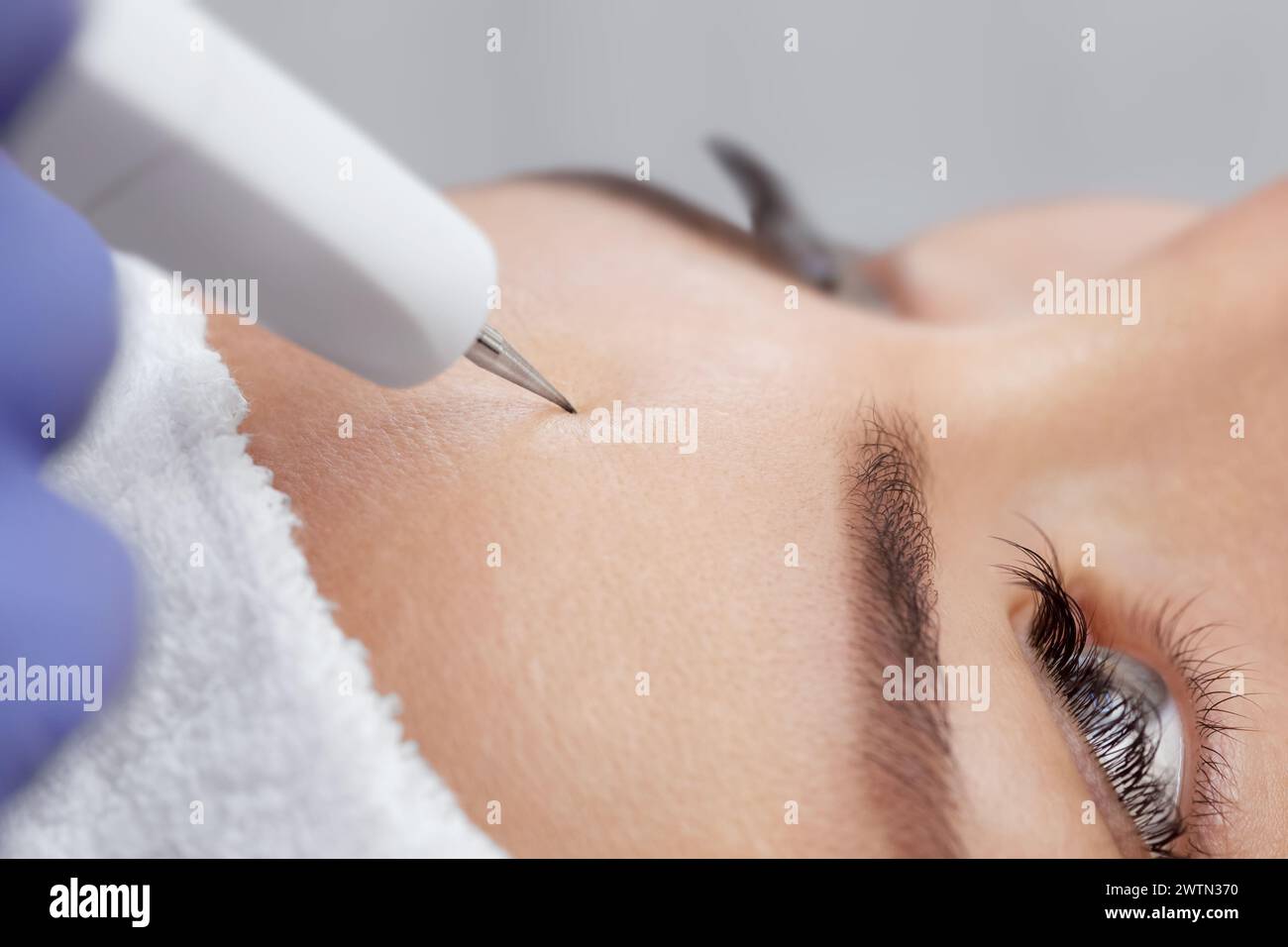 The cosmetologist makes the procedure treatment of Couperose of the facial skin of a beautiful, young woman in a beauty salon.Cosmetology and professi Stock Photo