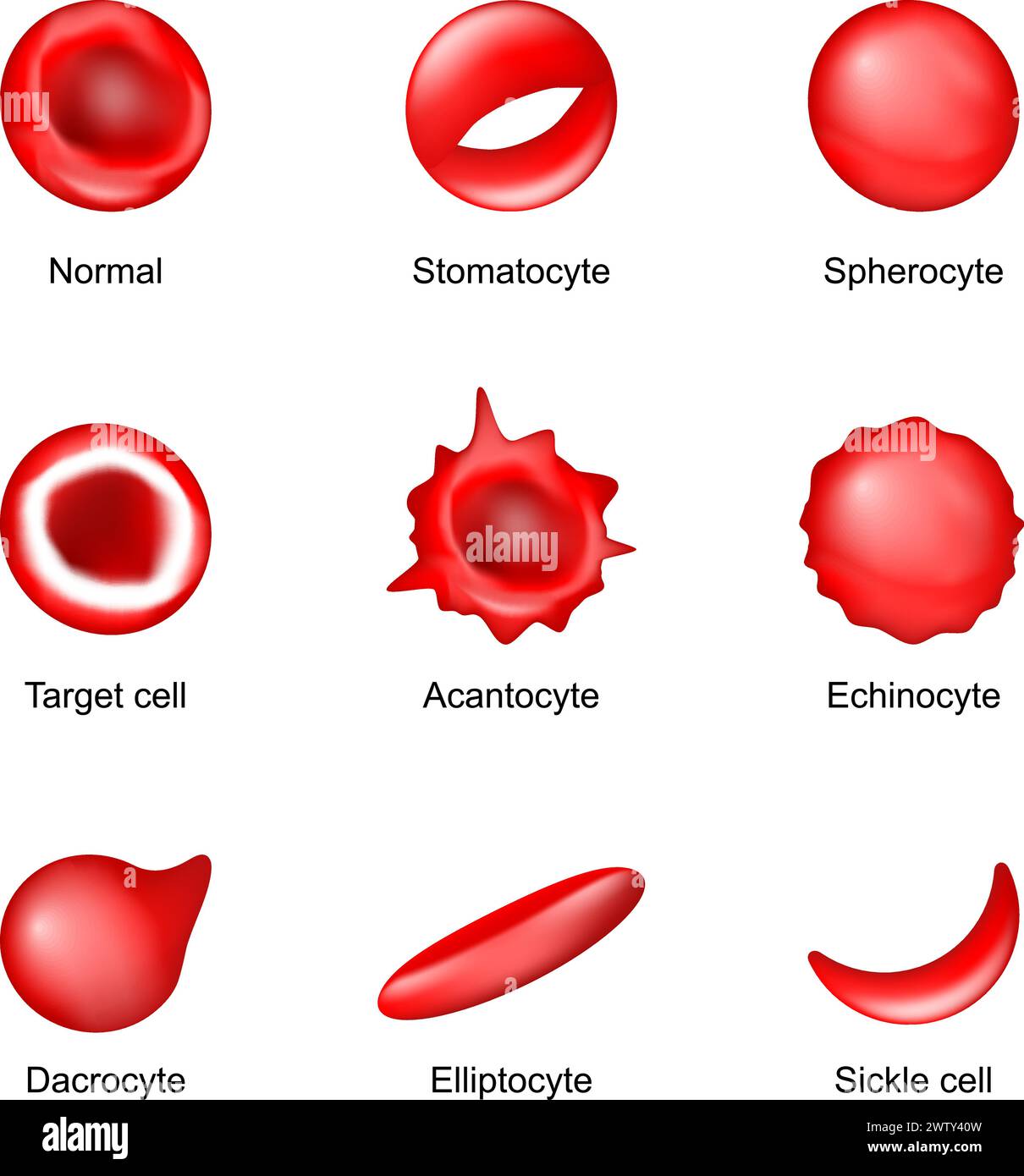Shape of red blood cell. Sickle cell, Echinocyte, Spherocyte, Elliptocyte, Acantocyte, Stomatocyte, Dacrocyte, Target cell and Normal Erythrocyte. Poi Stock Vector