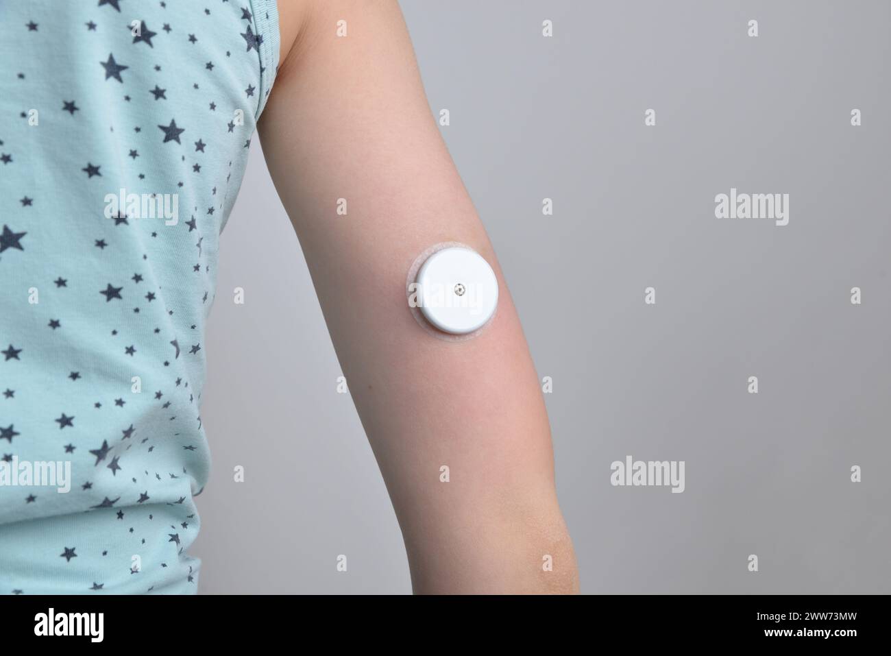 Child's hand with white sensor for continuous glucose monitoring. Concept of health, diabetes management, medical technology, and monitoring solutions Stock Photo