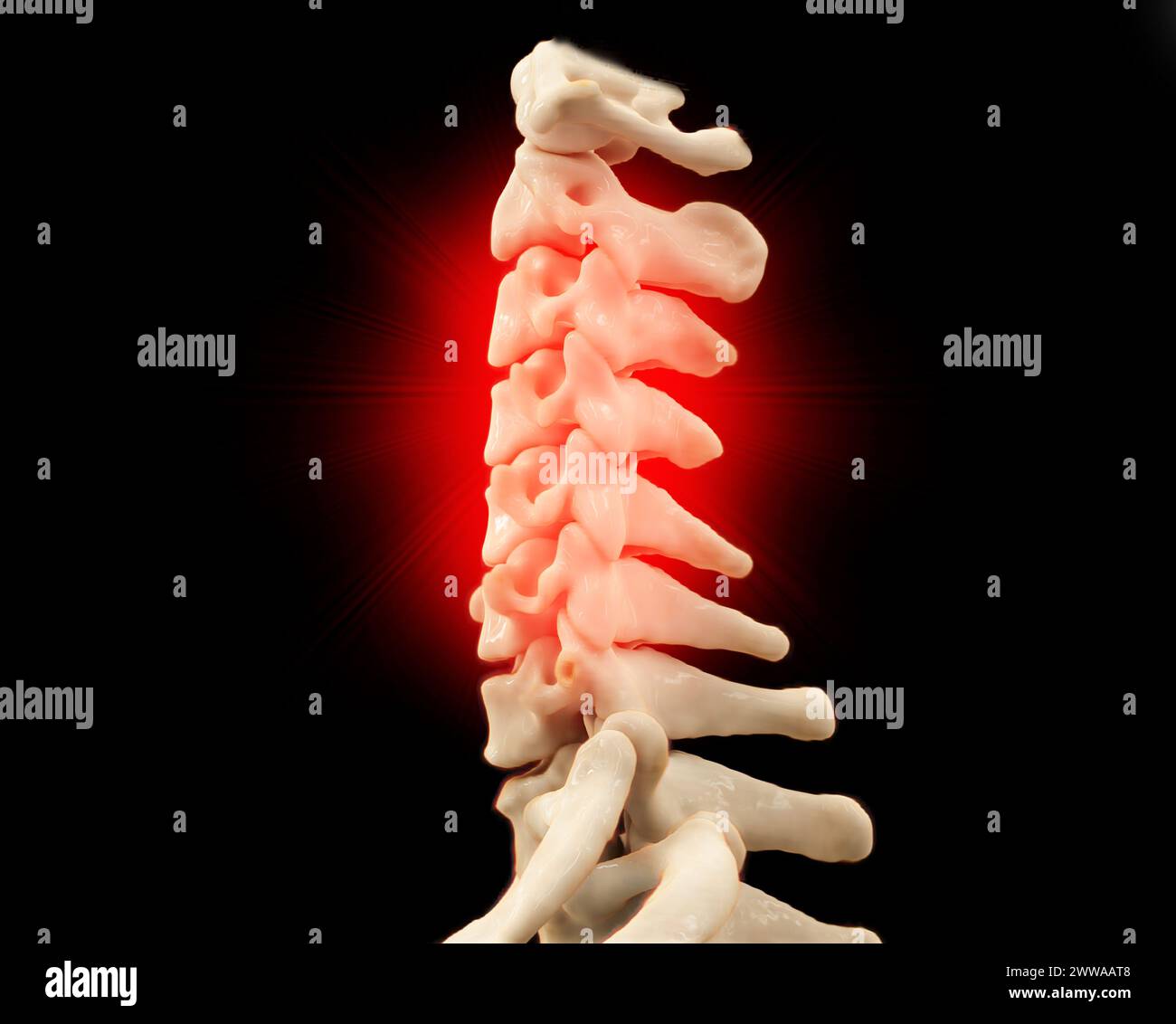 CT scan of C-Spine or Cervical spine 3D rendering Stock Photo - Alamy