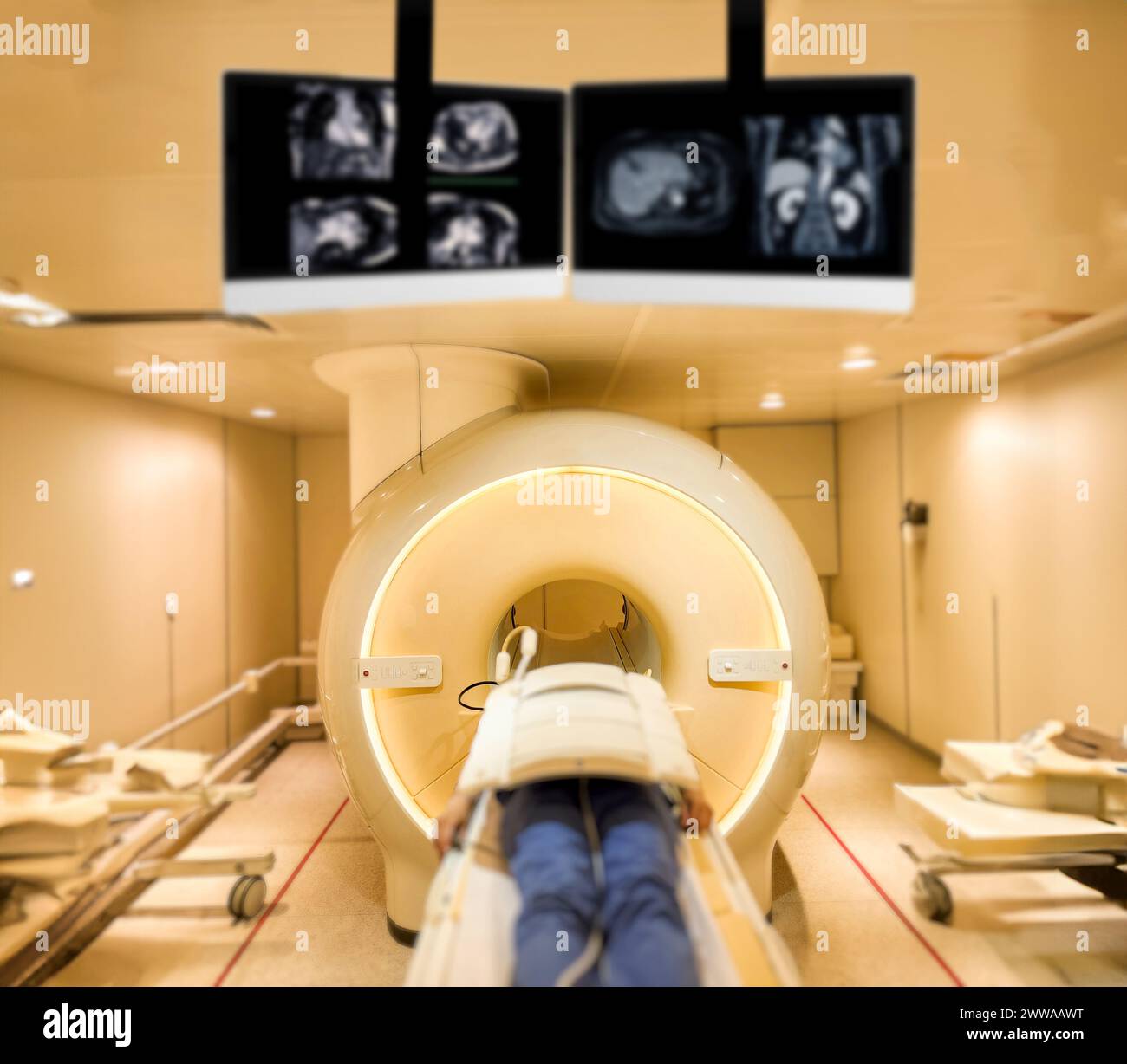 A patient lies down comfortably on the MRI scanner, undergoing a relaxing MRI scan to assess the upper abdomen, providing crucial medical insights. Stock Photo