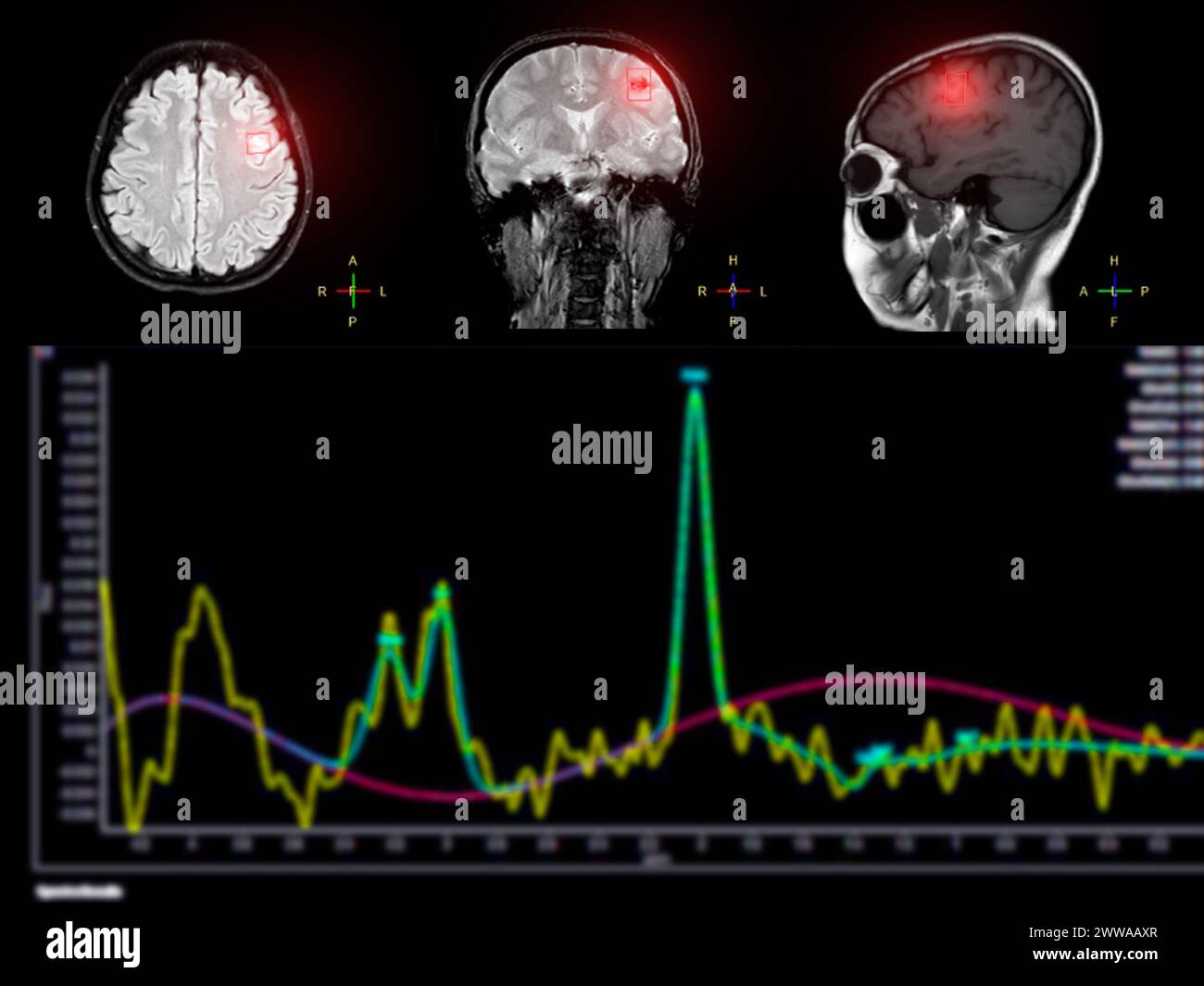 Mr spectroscopy hi-res stock photography and images - Alamy