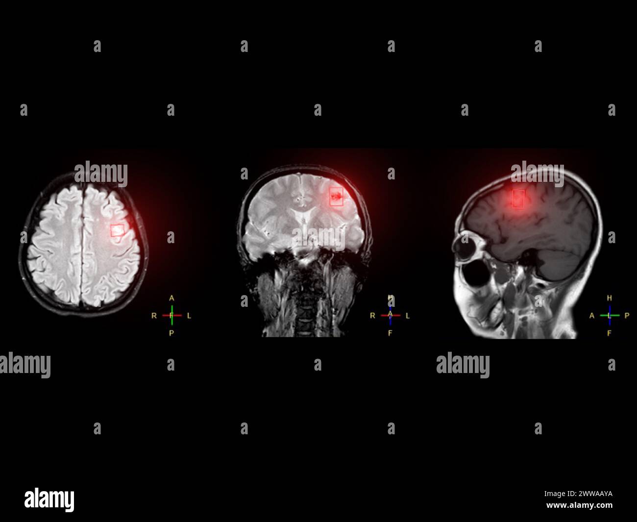 Mr spectroscopy hi-res stock photography and images - Alamy