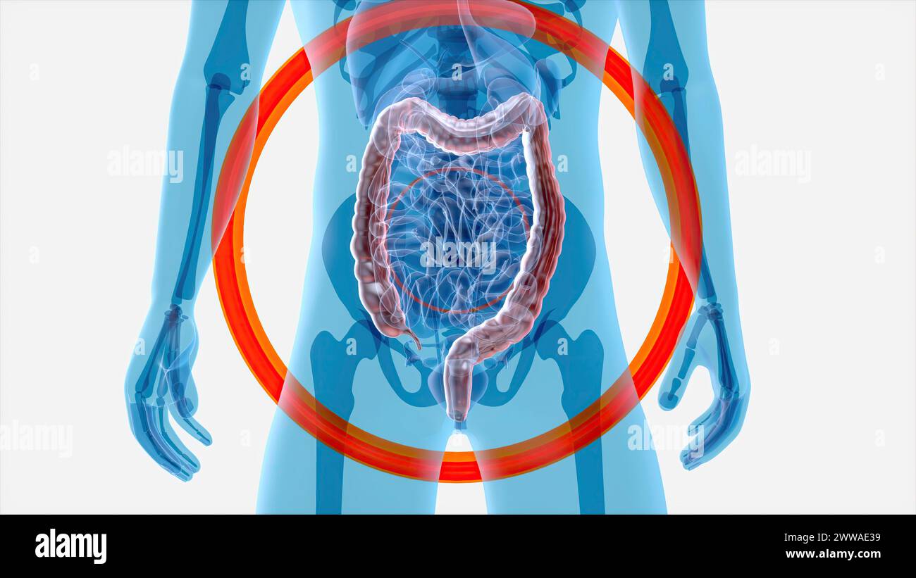 Large intestine, illustration Stock Photo - Alamy