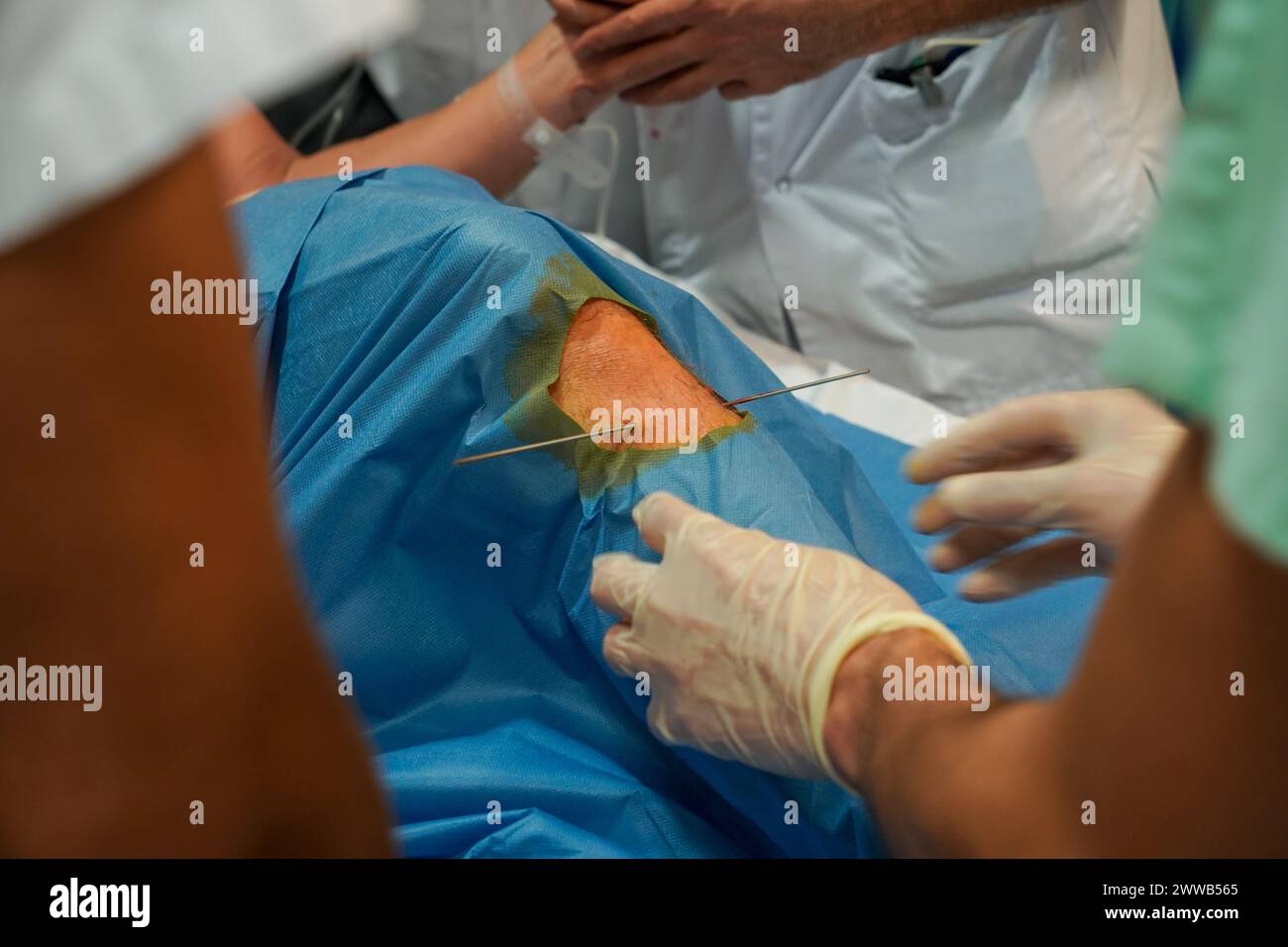 Patient in the shock ward in the intensive care unit of a university