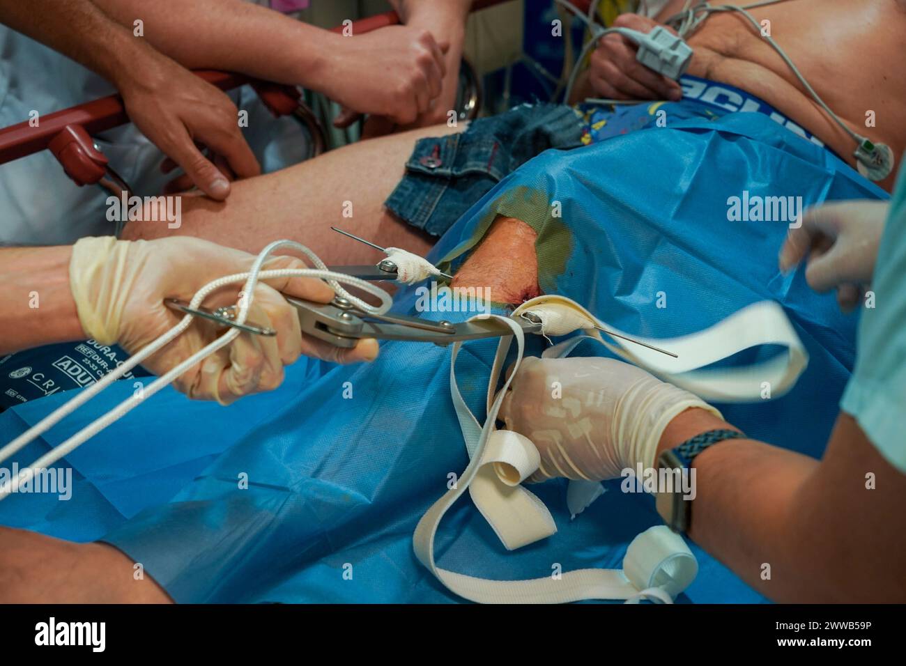 Patient in the shock ward in the intensive care unit of a university