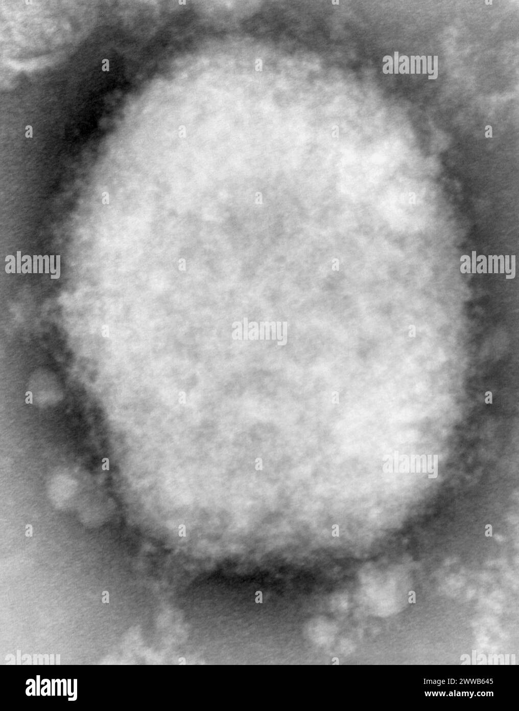 This highly magnified negative spot transmission electron micrograph (TEM) image reveals a type M monkeypox virus, or mulberry. Stock Photo