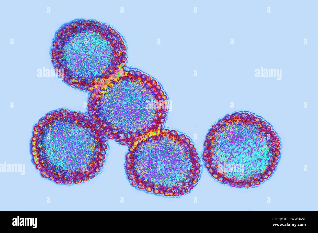 Influenza virus. Viruses of the Orthomyxoviridae family. Avian plague virus. Stock Photo