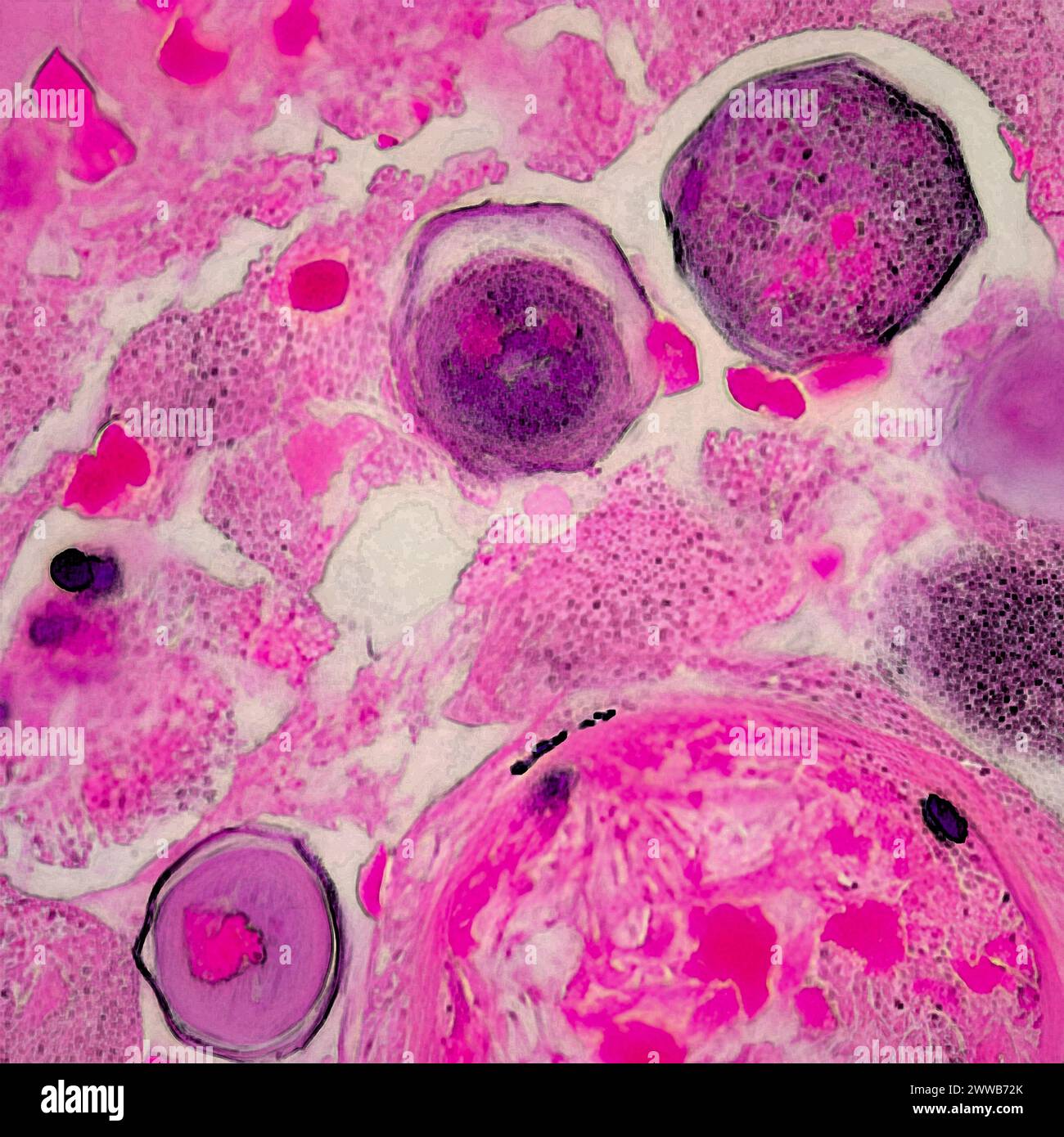 Free Living Amoeba