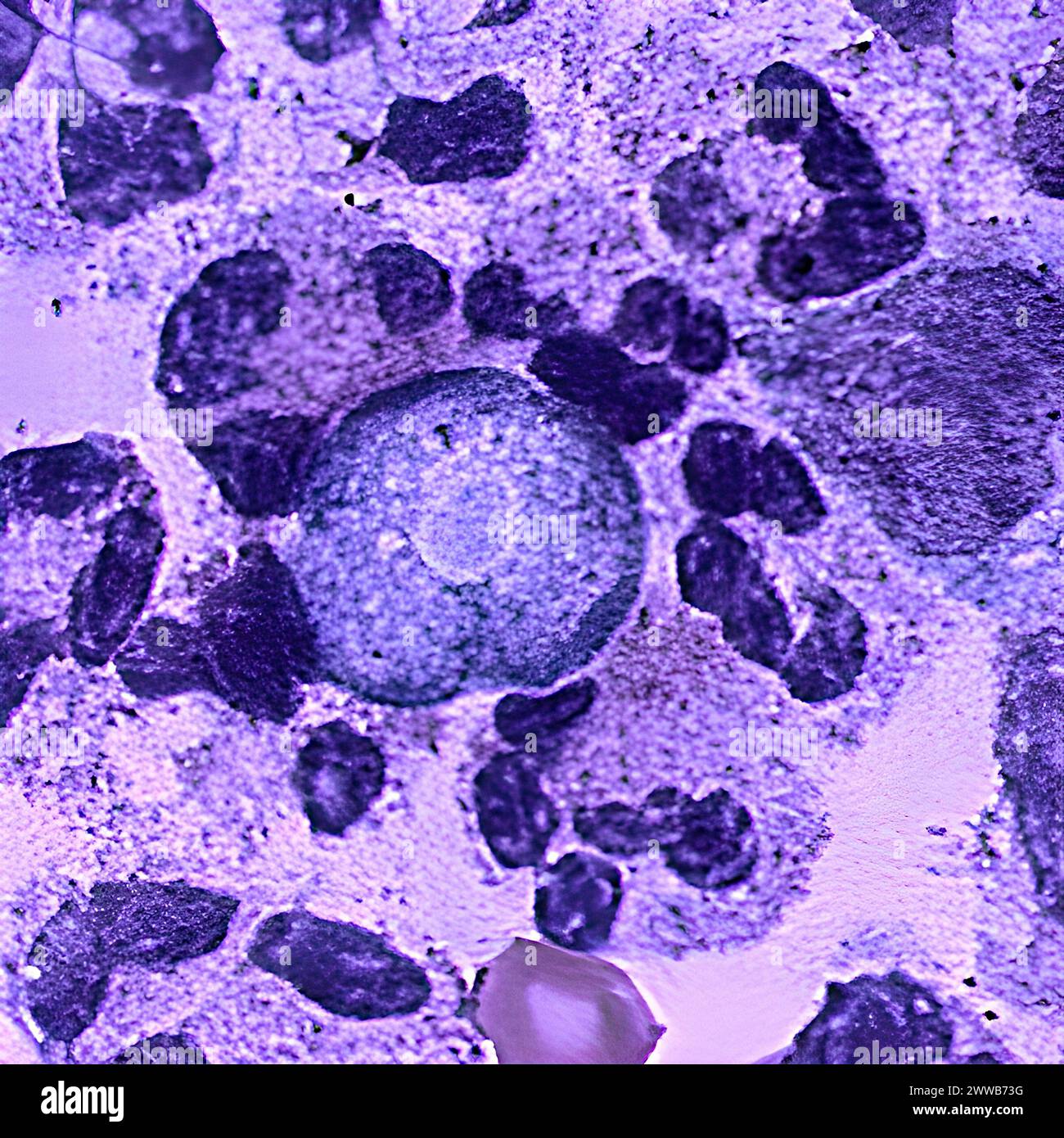 Naegleria fowleri is an amoeba (one-celled living organism) that lives