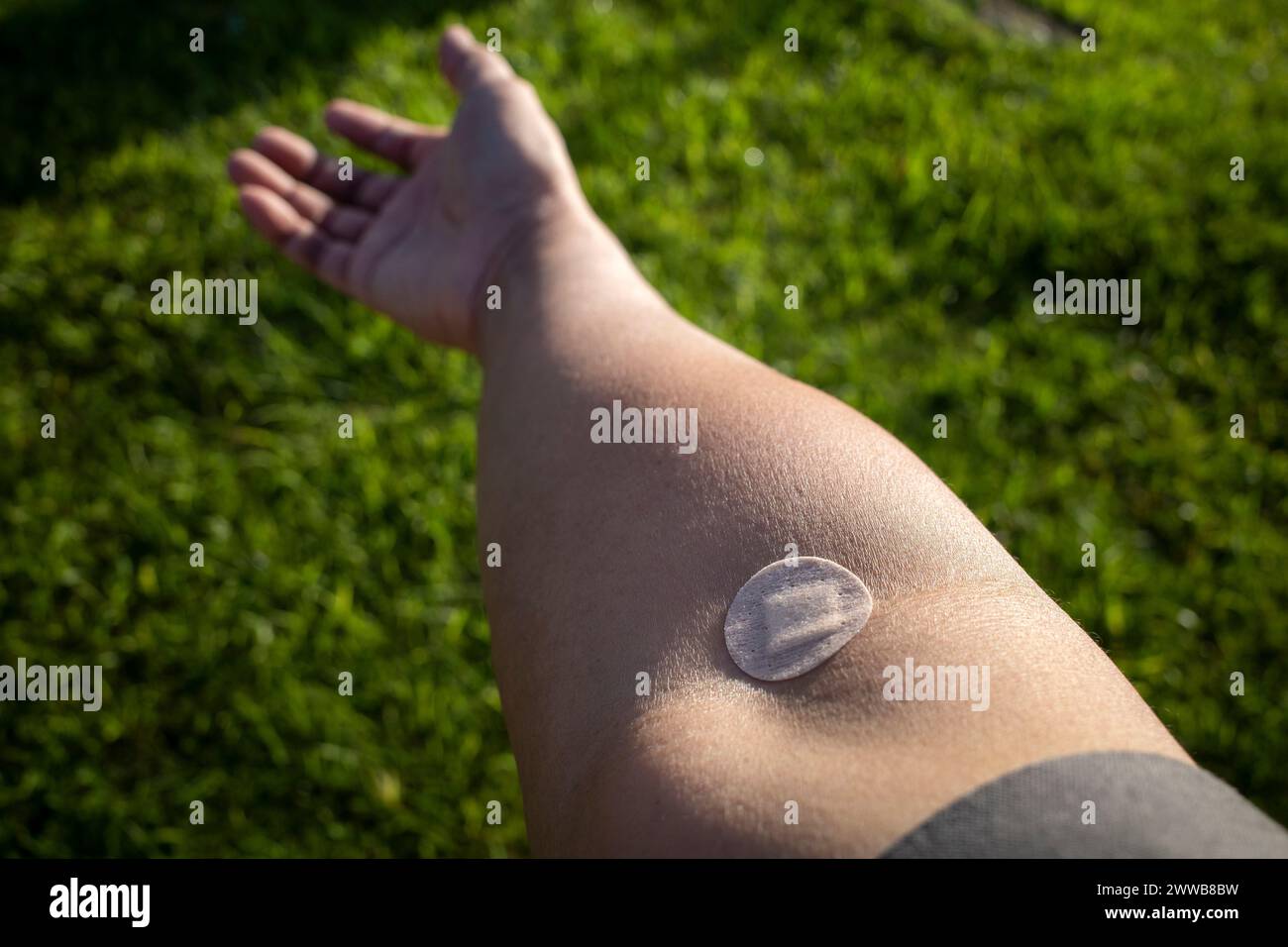 A band aid on right arm after taking blood sample from vein for analysis in medical laboratory