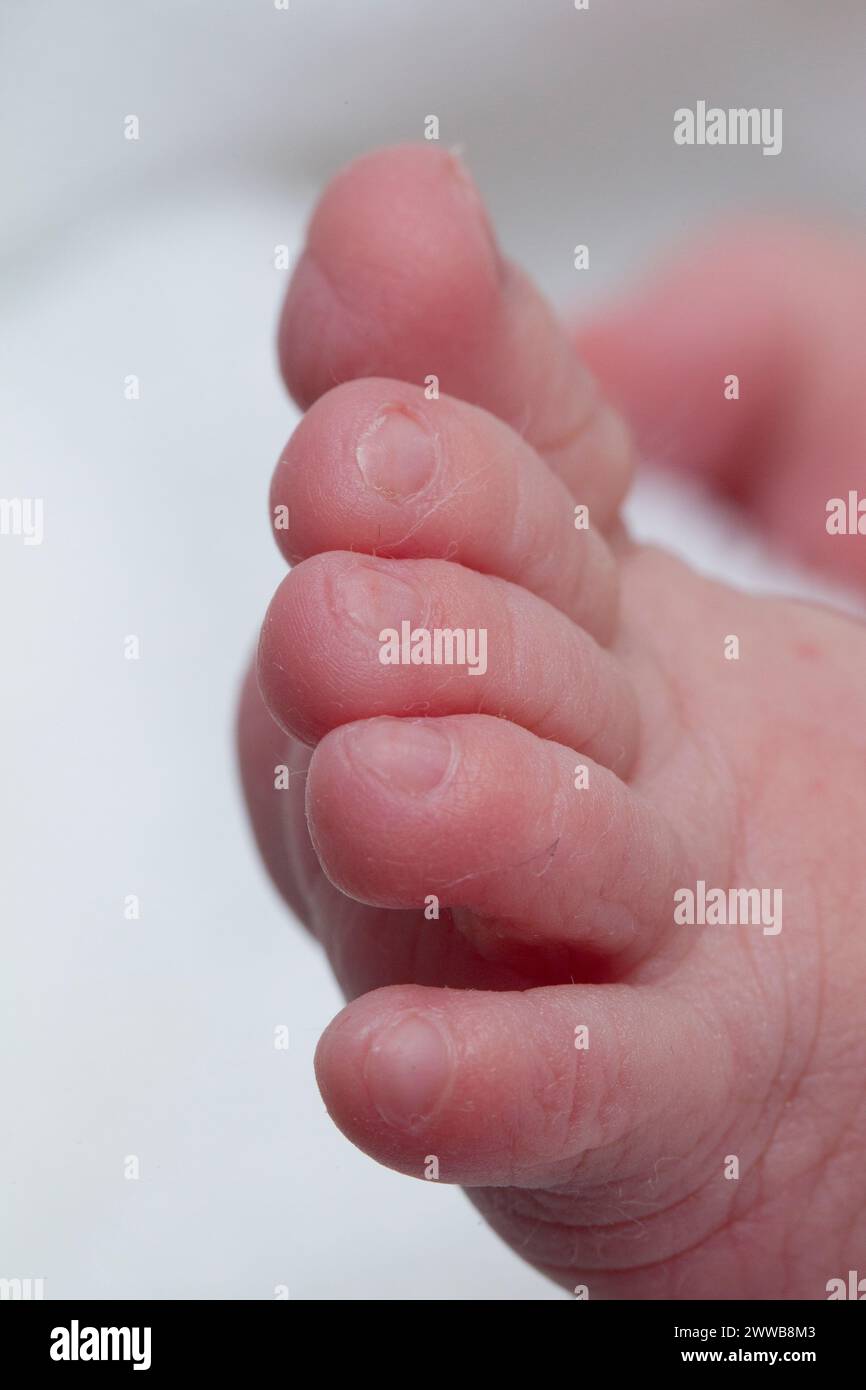 Close up shots of 1 day old newborn feet. Stock Photo