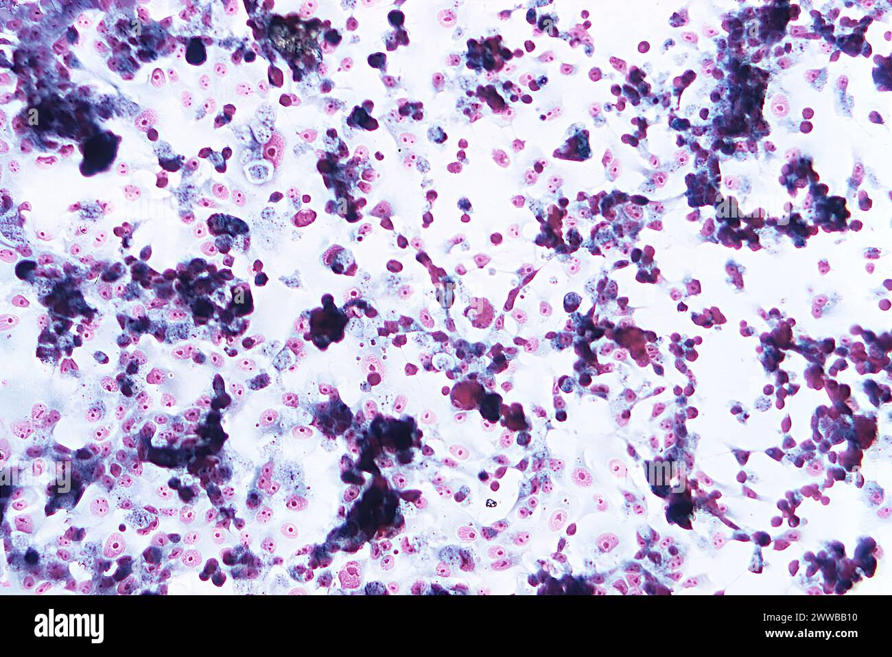 Under 125X magnification, this 1973 photomicrograph of a trichrome-stained sample of human brain tissue revealed the presence of Naegleria gruberi. Stock Photo