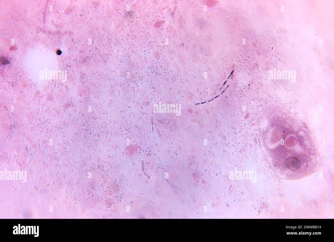 Under 675X magnification, this photomicrograph revealed the presence of ...