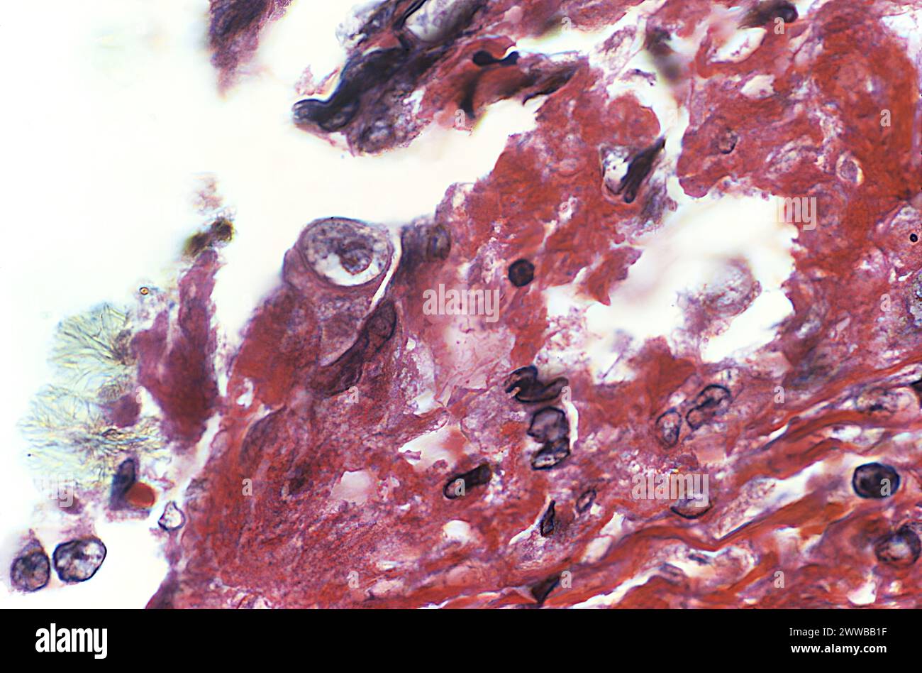 1975 Dr. Visvesvara Magnified 1000X, this photomicrograph revealed the ...